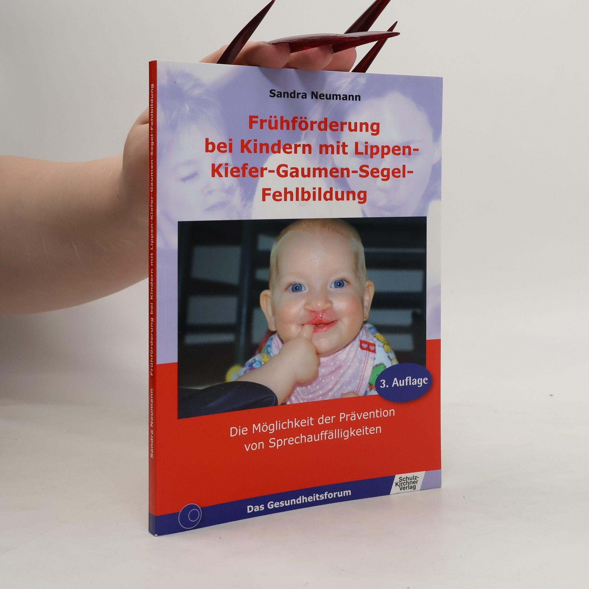 Frühförderung bei Kindern mit Lippen-Kiefer-Gaumen-Segel-Fehlbildung