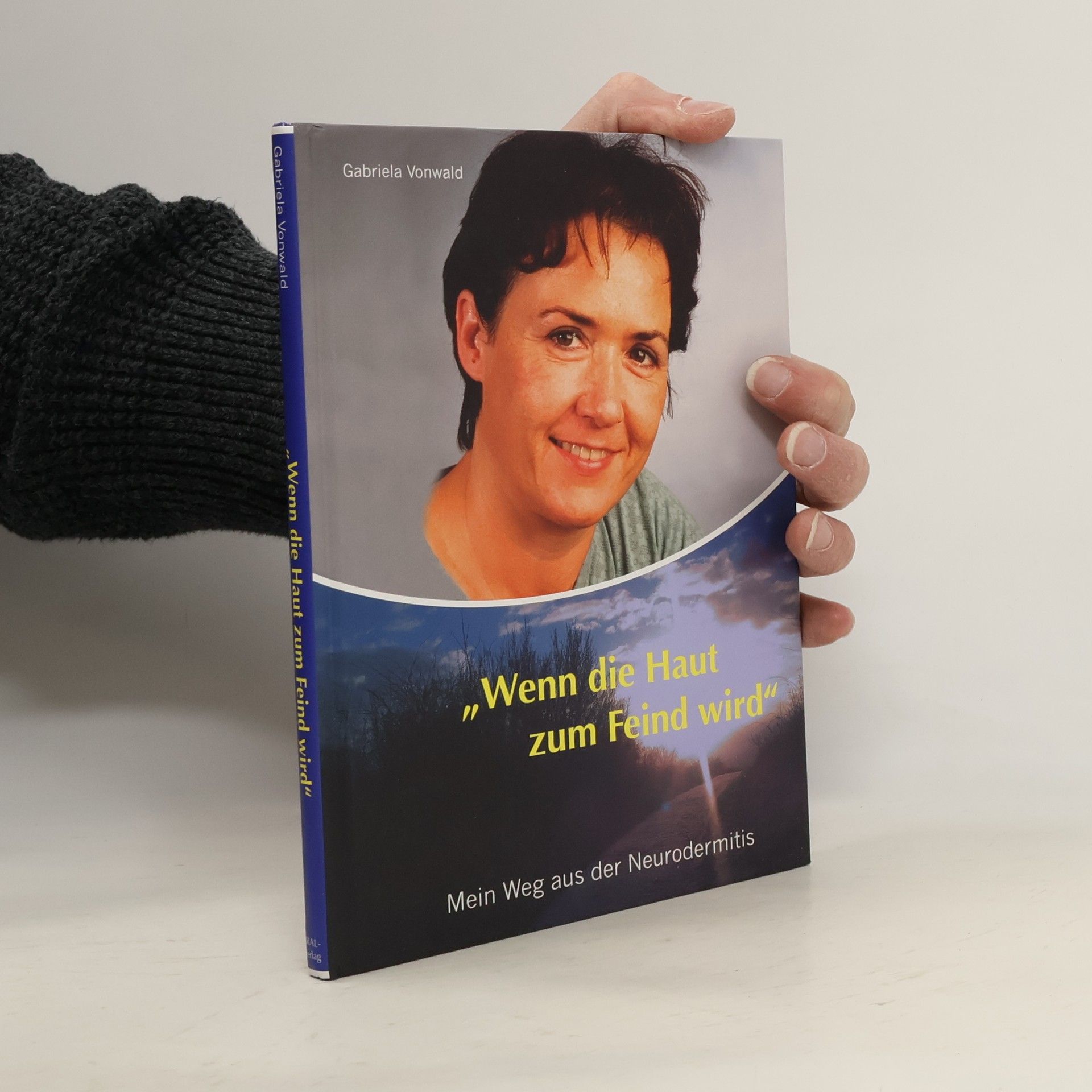 Wenn die Haut zum Feind wird