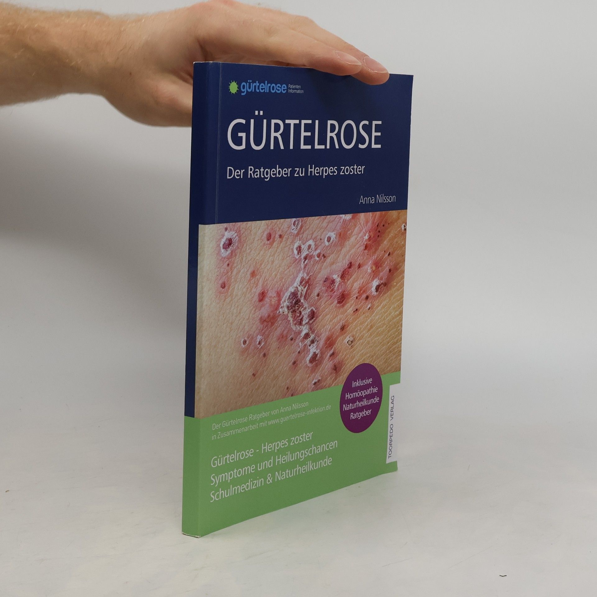 Fr Anna Nilsson Gürtelrose - Der große Ratgeber zu Herpes zoster