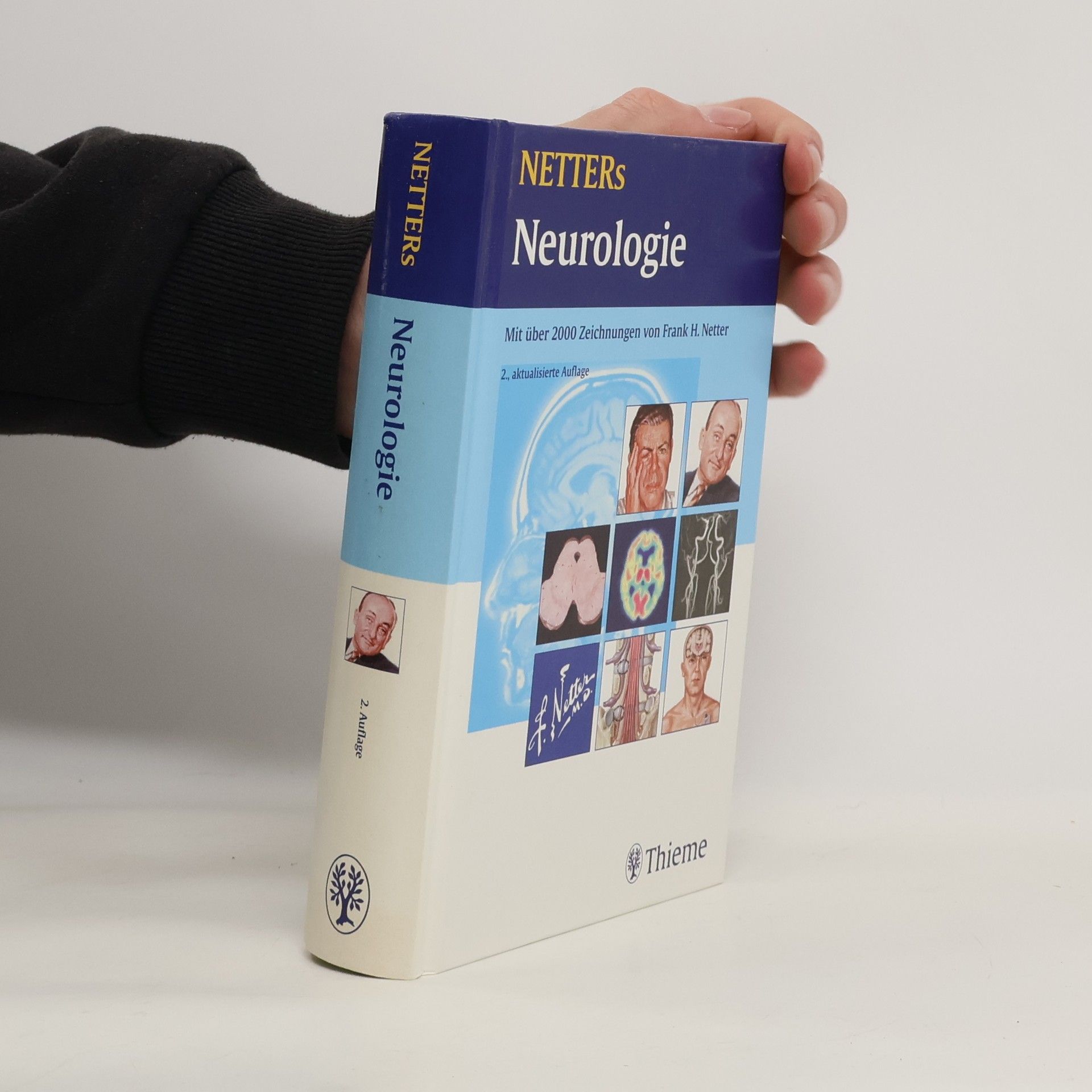 Netters Neurologie