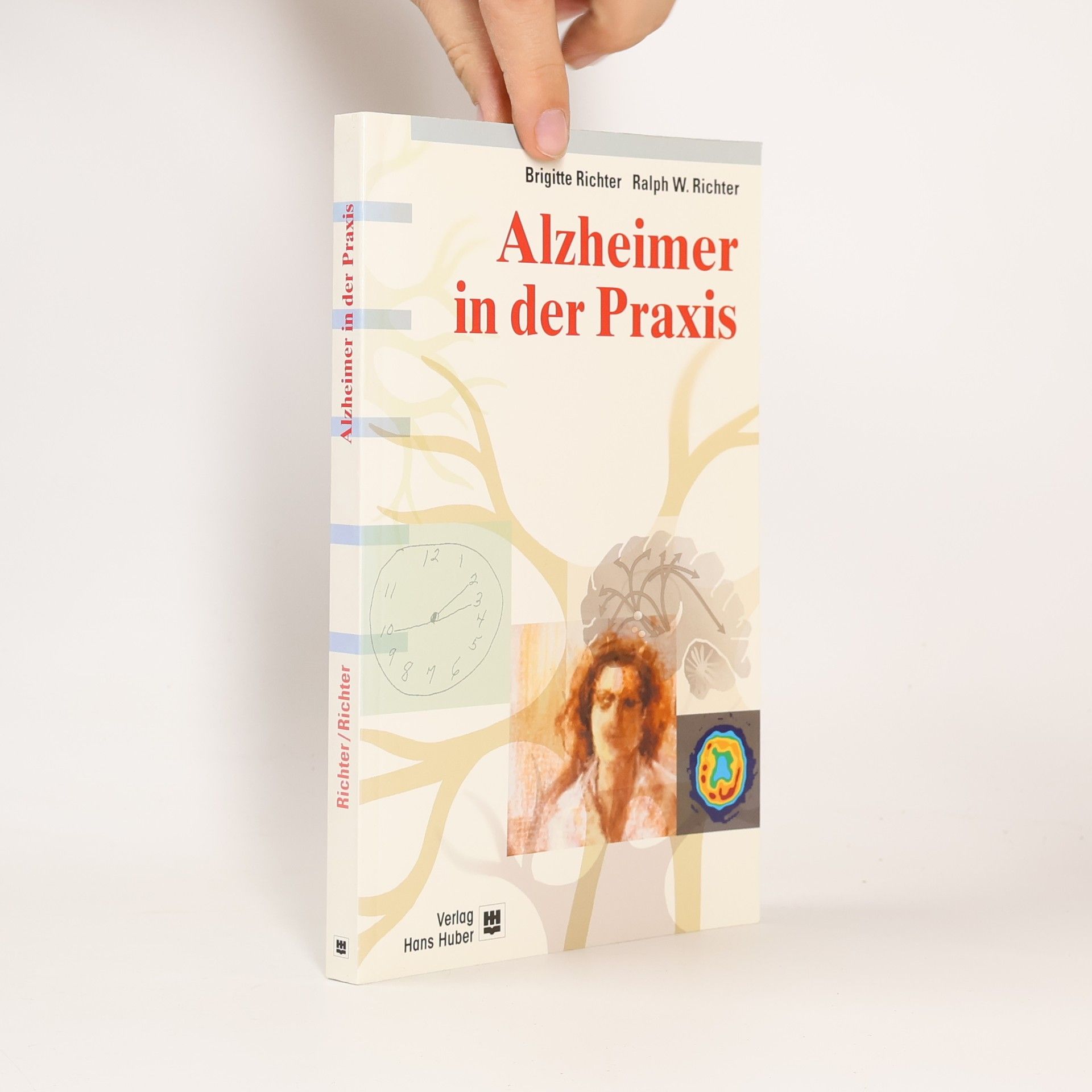 Alzheimer in der Praxis