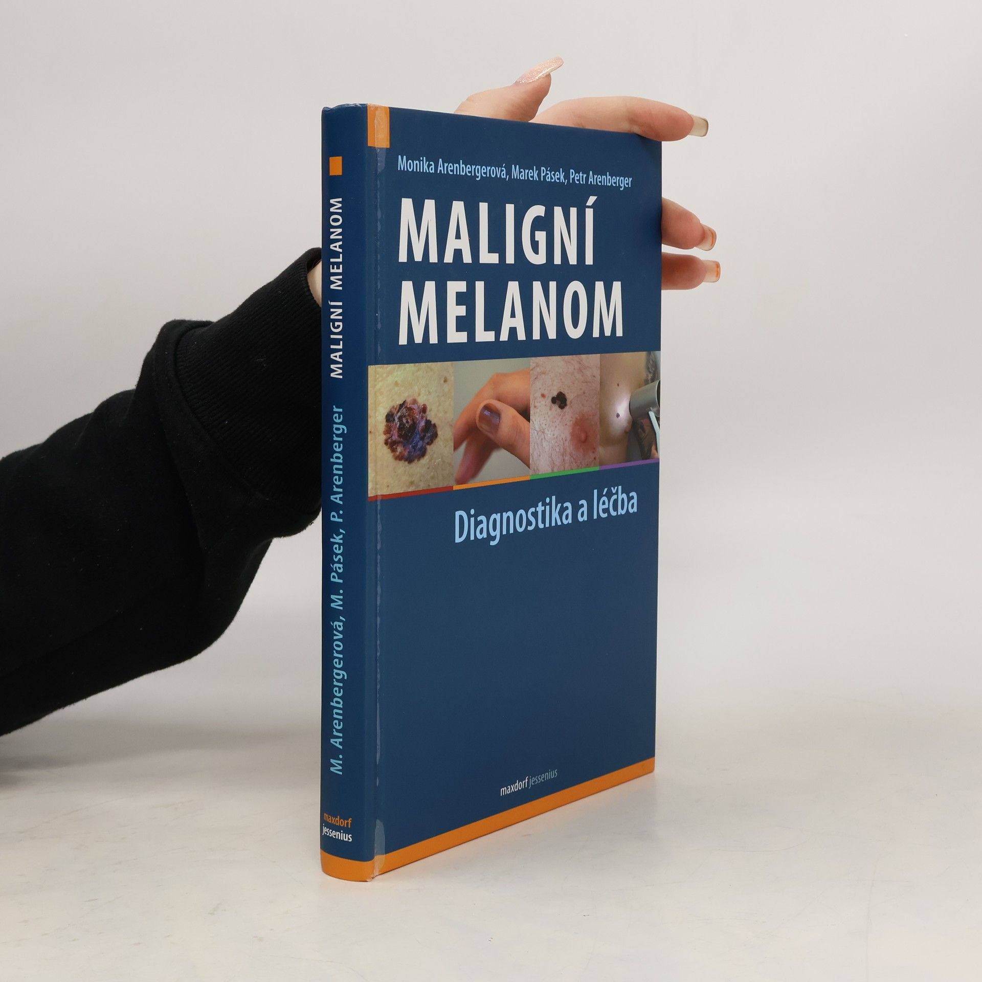 Monika Arenbergerová Maligní melanom: diagnostika a léčba na základě aktuálního doporučeného postupu