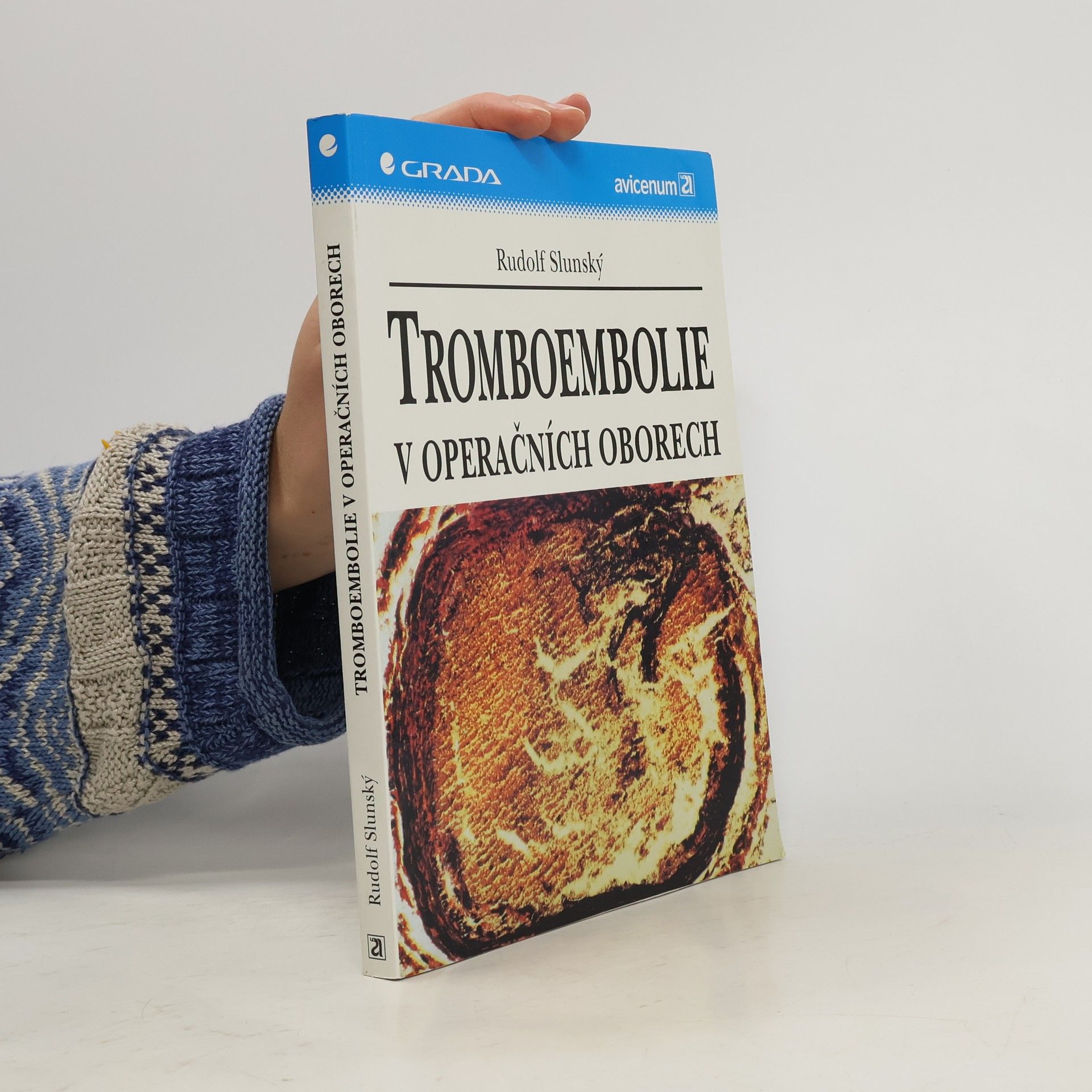 Rudolf Slunský Tromboembolie v operačních oborech