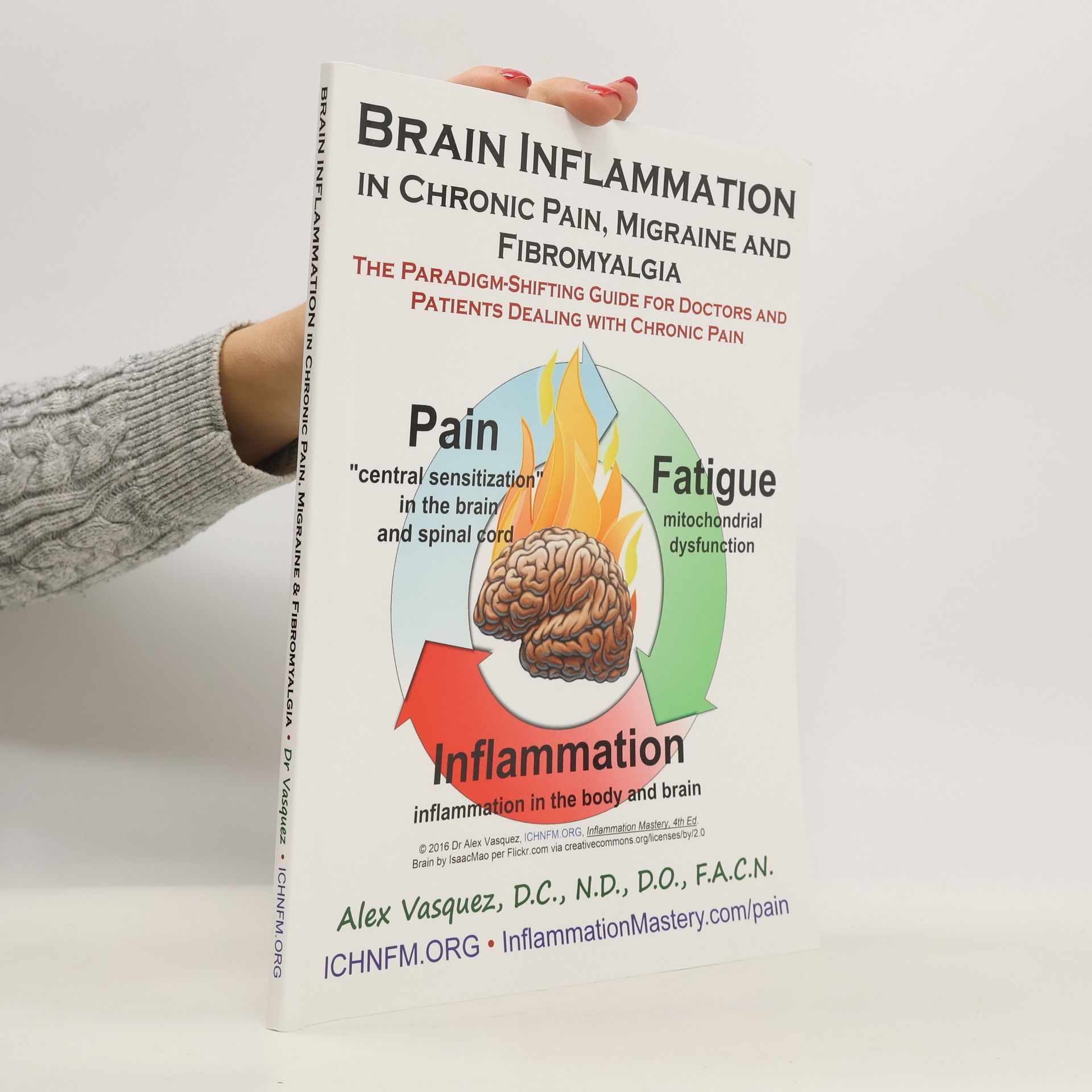 Alex M. Vasquez Brain Inflammation in Chronic Pain, Migraine and Fibromyalgia