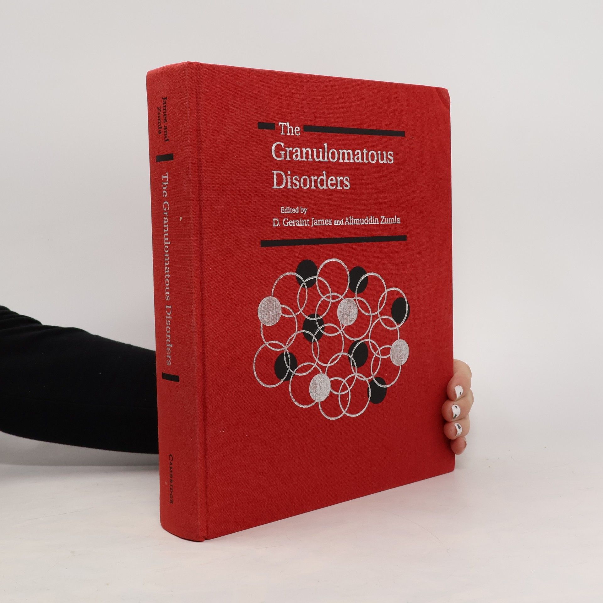 Alimuddin Zumla The Granulomatous Disorders