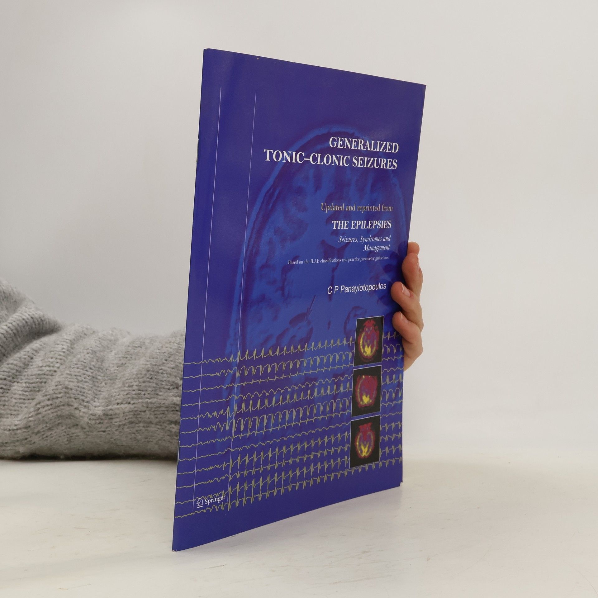 Kolektív autorov The Epilepsies + CD