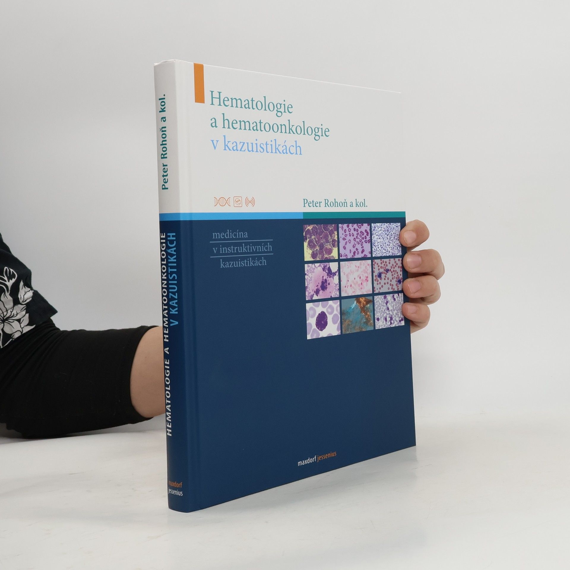 Peter Rohoň Hematologie a hematoonkologie v kazuistikách