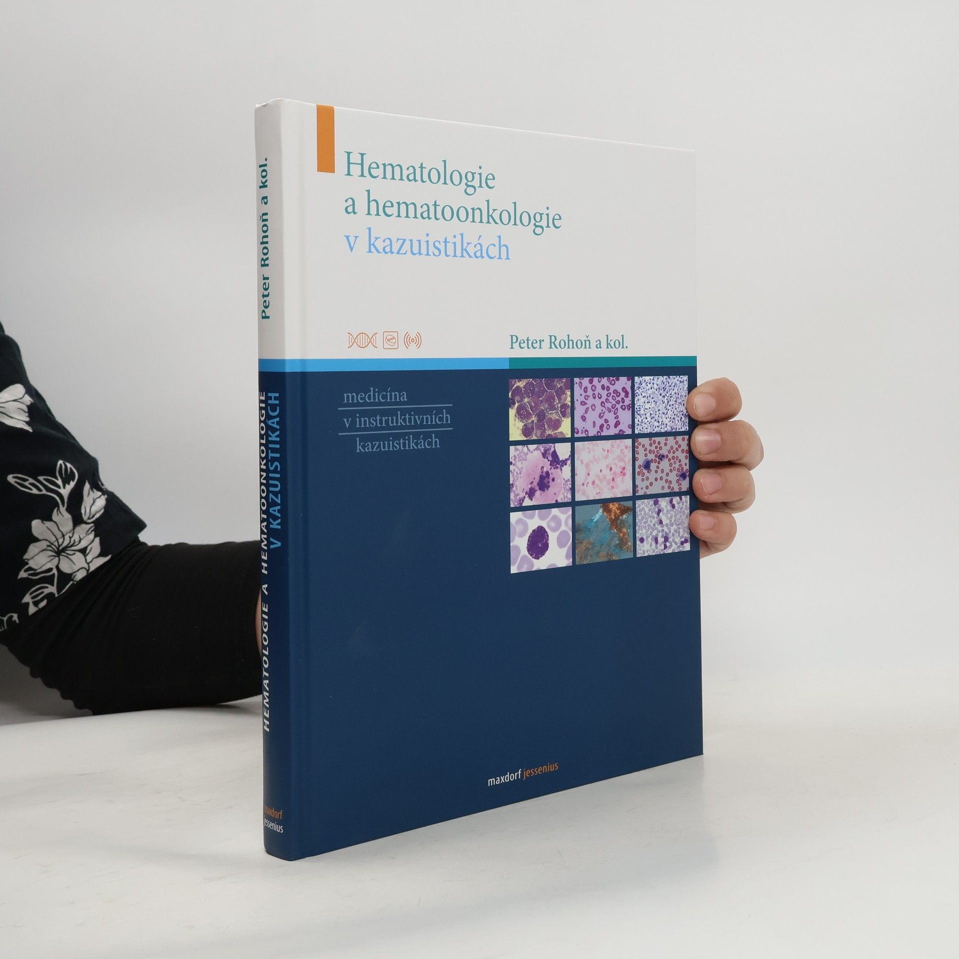 Peter Rohoň Hematologie a hematoonkologie v kazuistikách