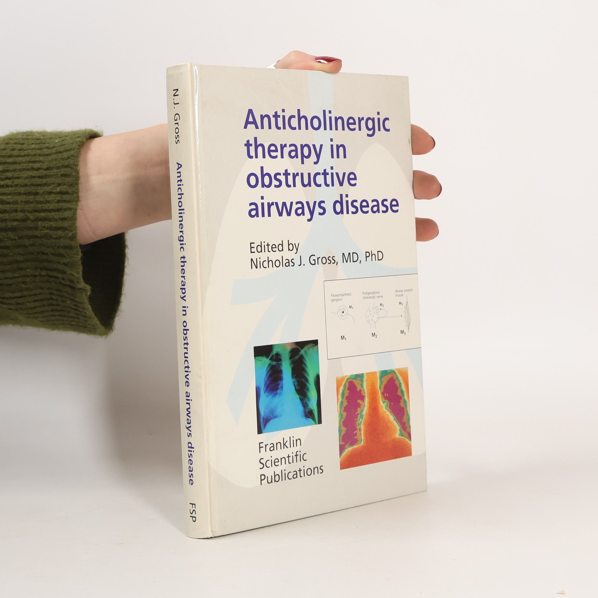 Nicholas J. Gross Anticholinergic Therapy in Obstructive Airways Disease
