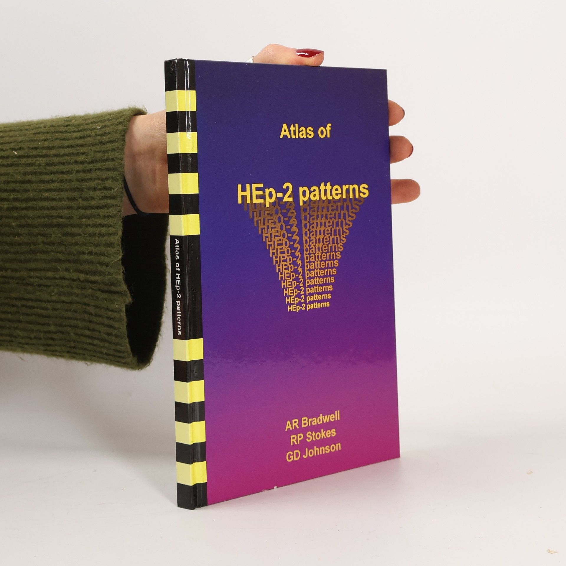 Atlas HEP-2 Patterns