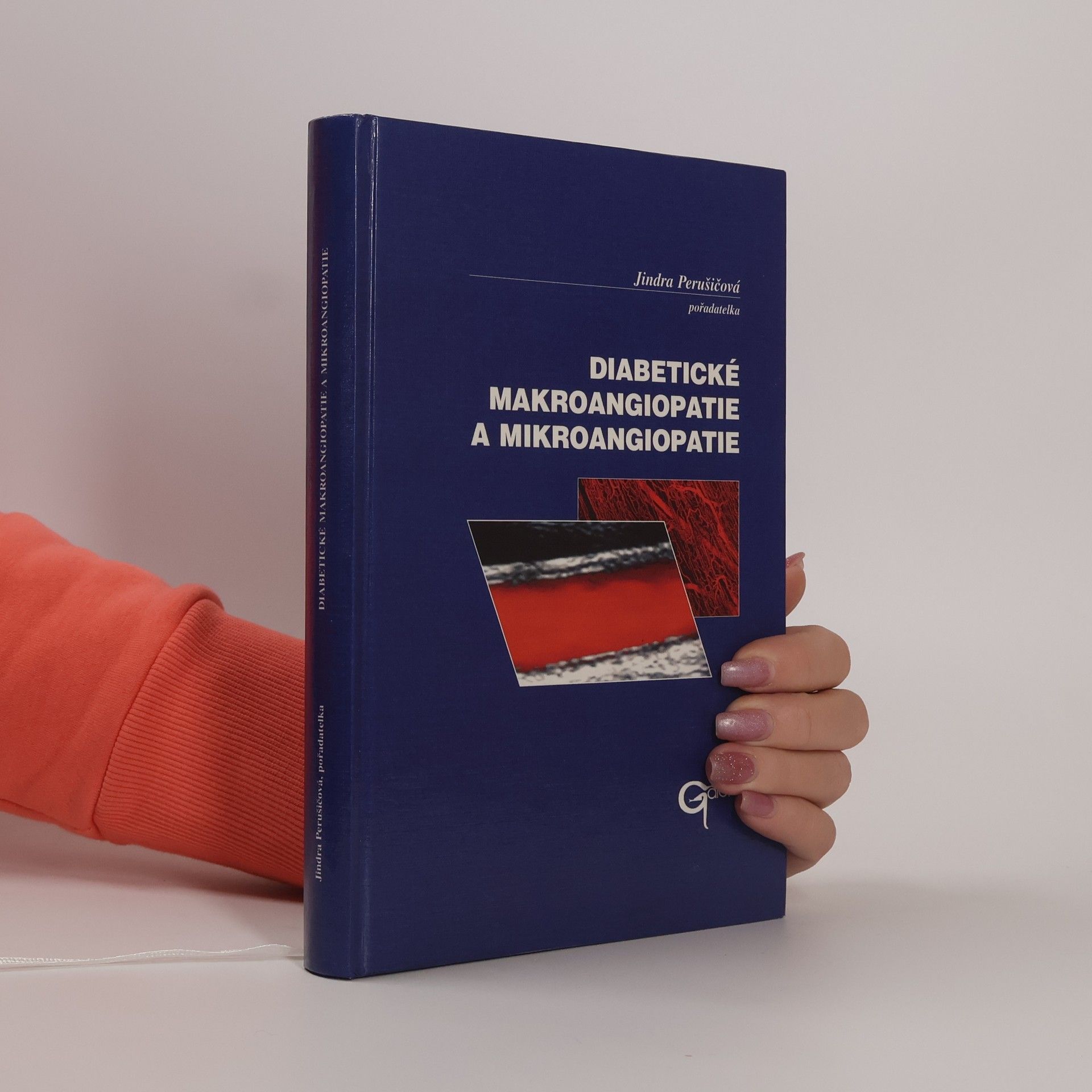 Jindřiška Perušičová Diabetické makroangiopatie a mikroangiopatie