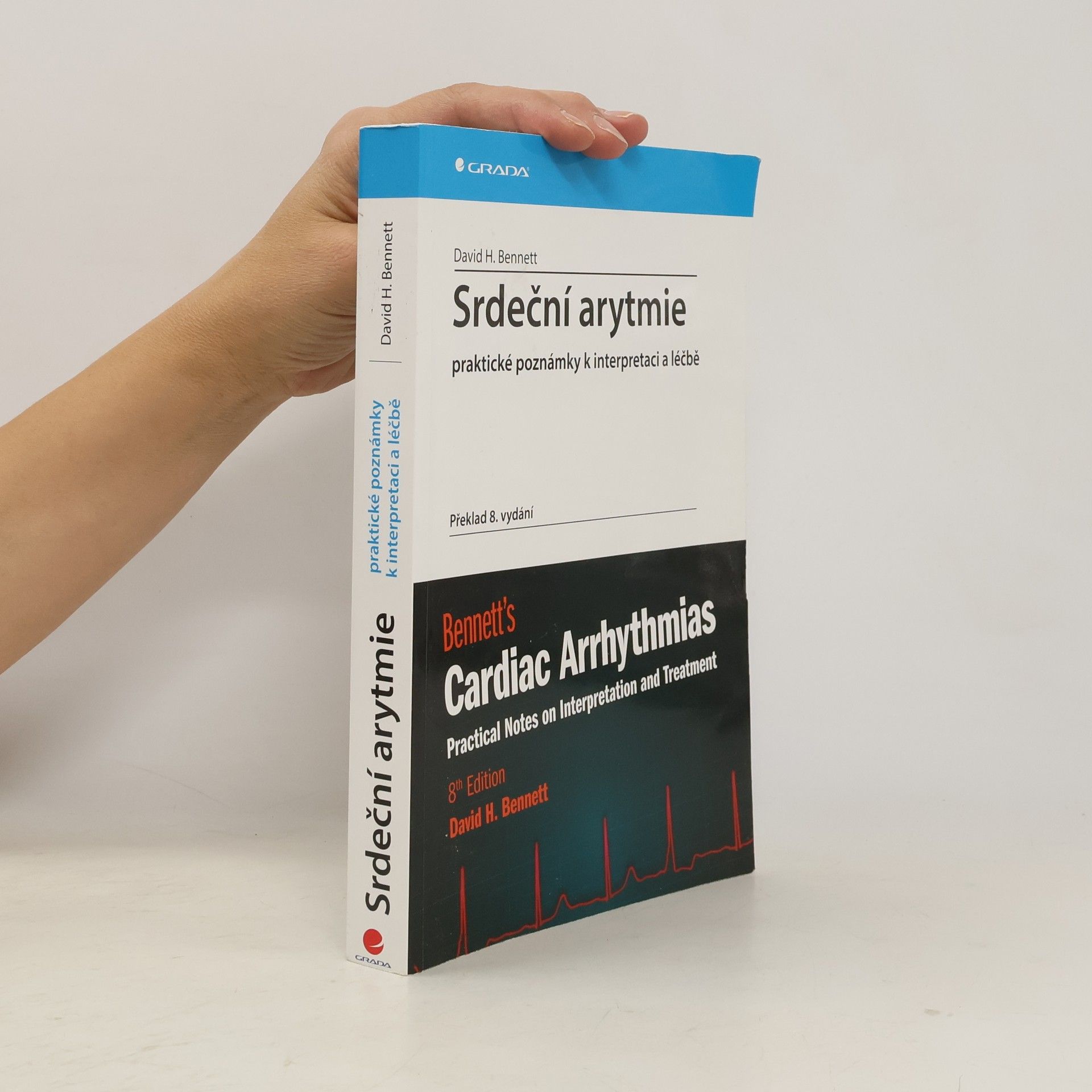 Srdeční arytmie - praktické poznámky k interpretaci a léčbě