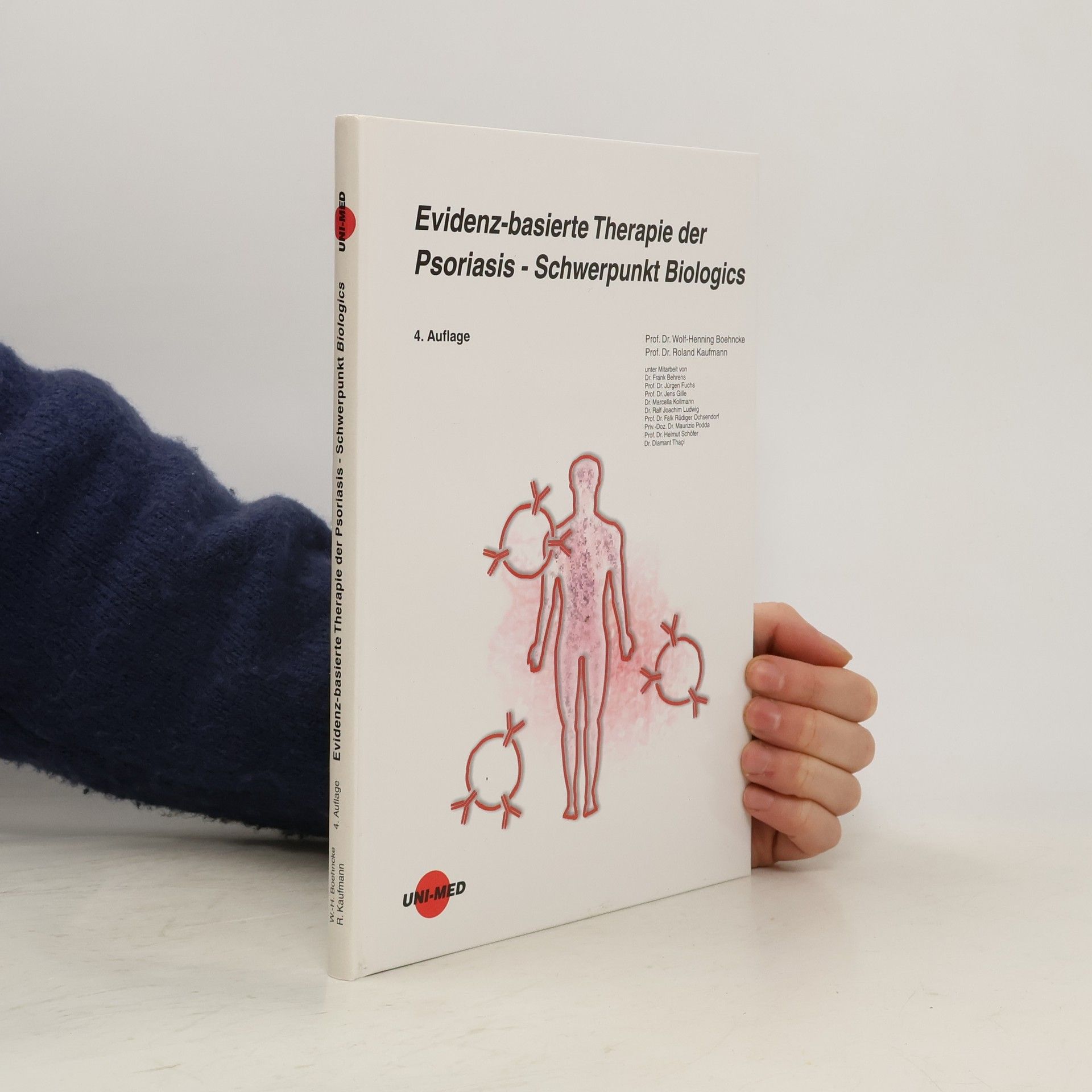 Collectif d'auteurs Evidenz-basierte Therapie der Psoriasis