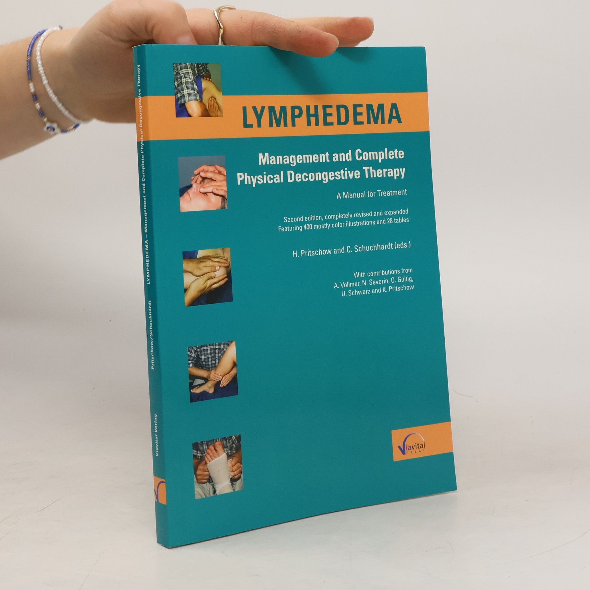 Hans Pritschow Lymphedema
