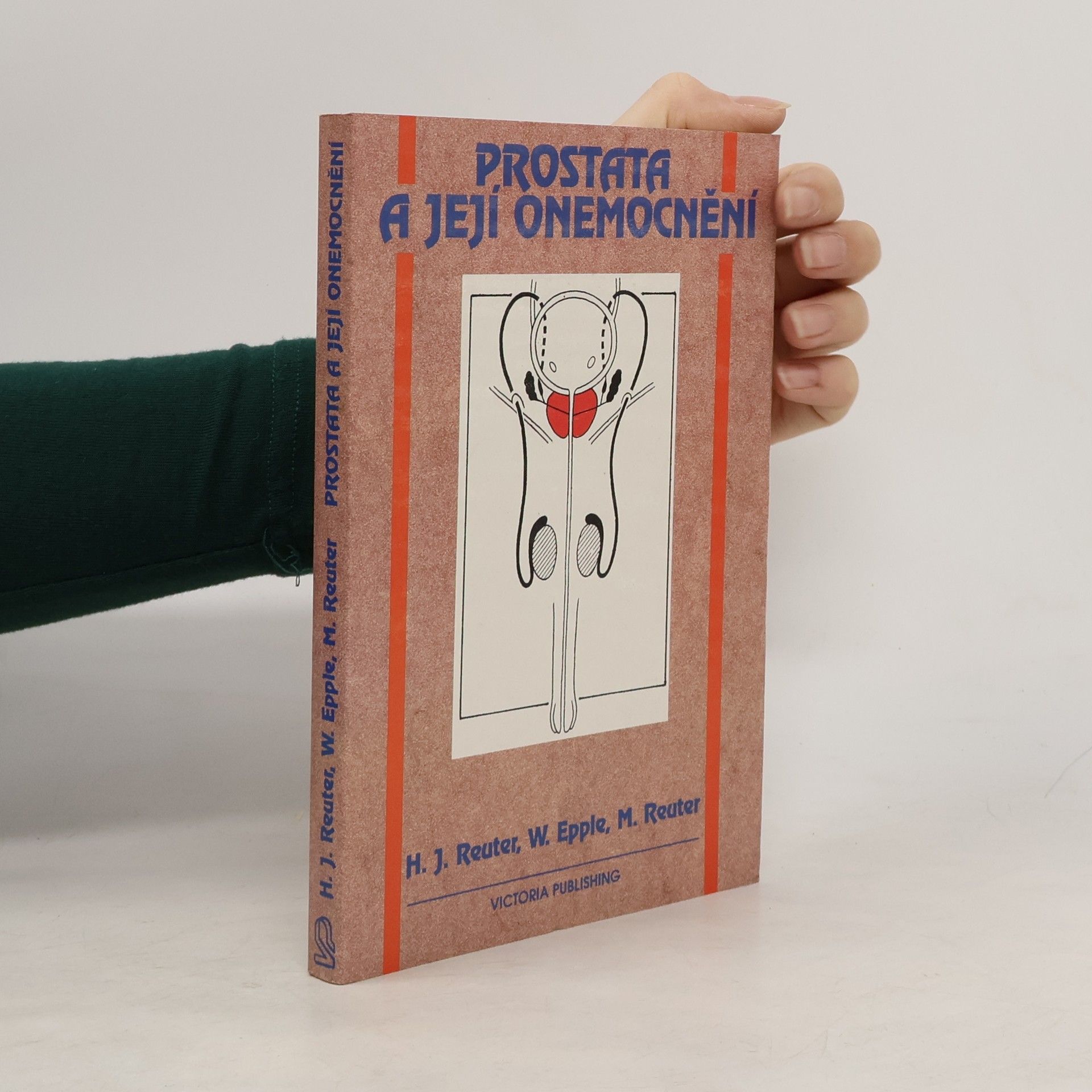 Prostata a její onemocnění