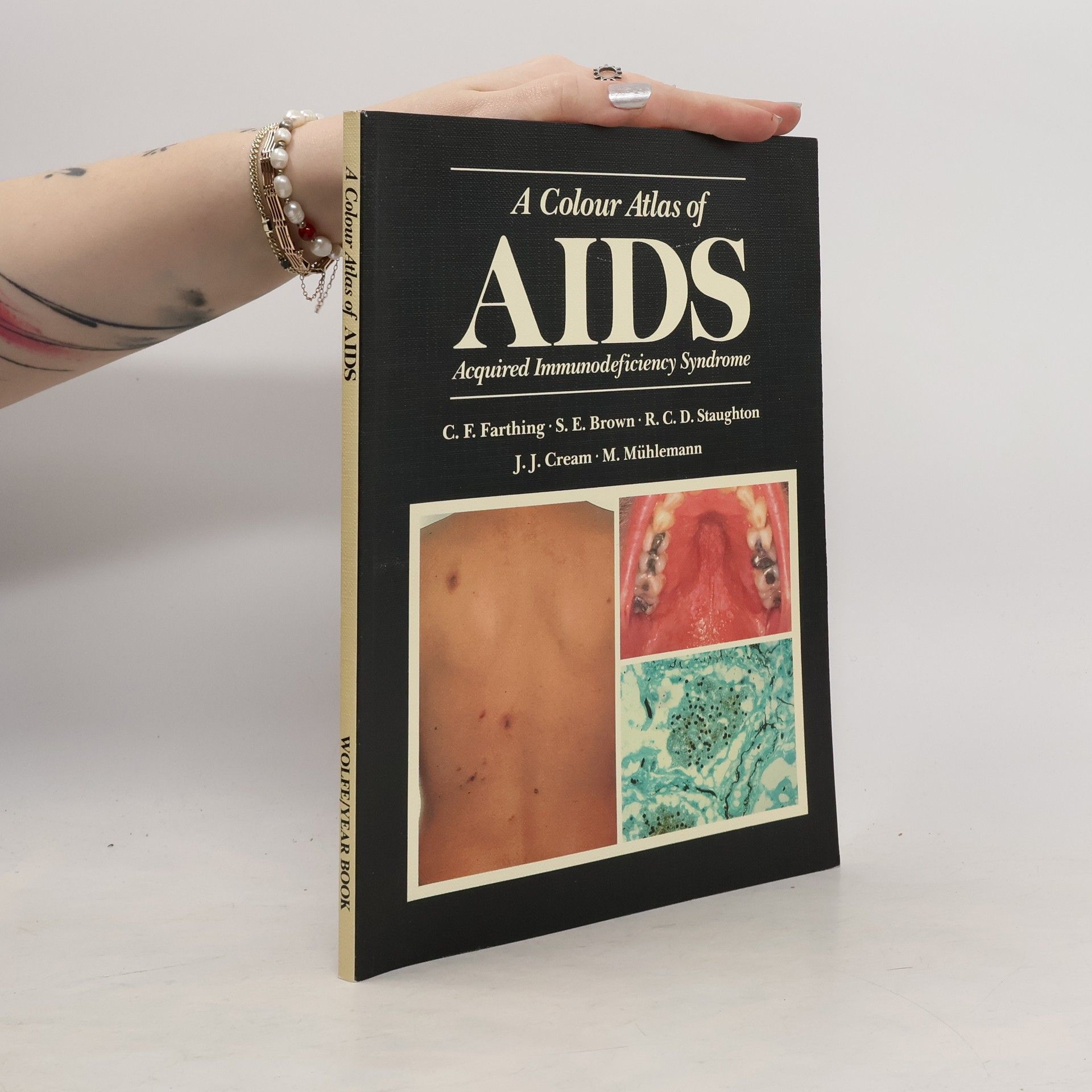 Charles F. Farthing A Colour Atlas of AIDS