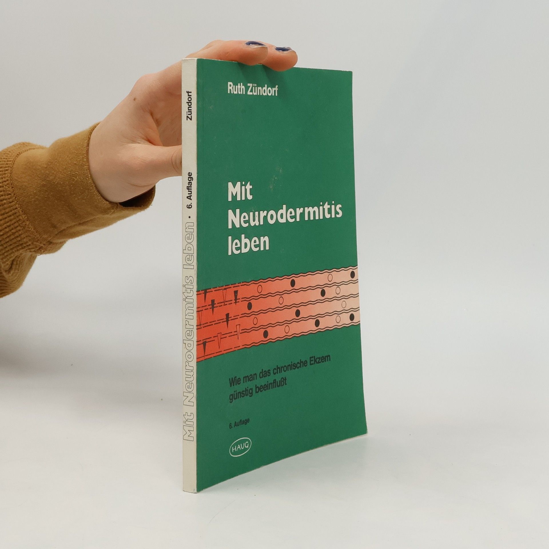 Ruth Zündorf Mit Neurodermitis leben