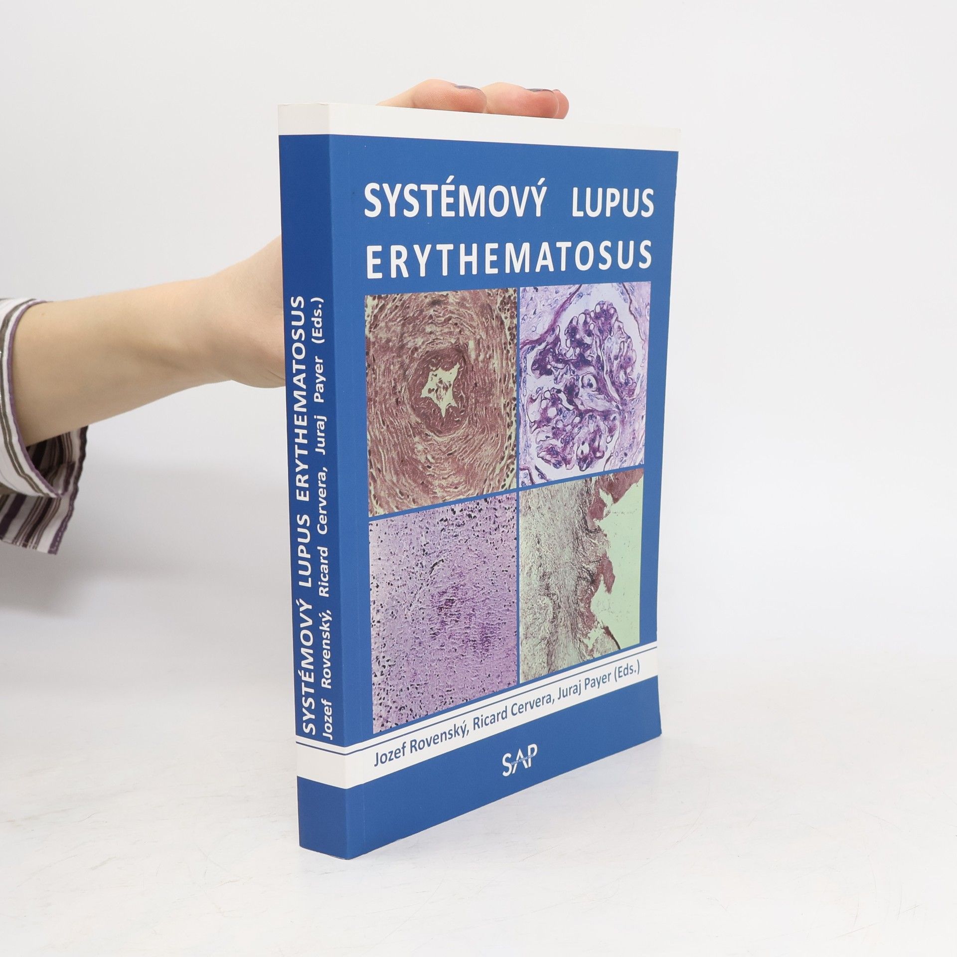 Jozef Rovenský Systémový lupus erythematosus