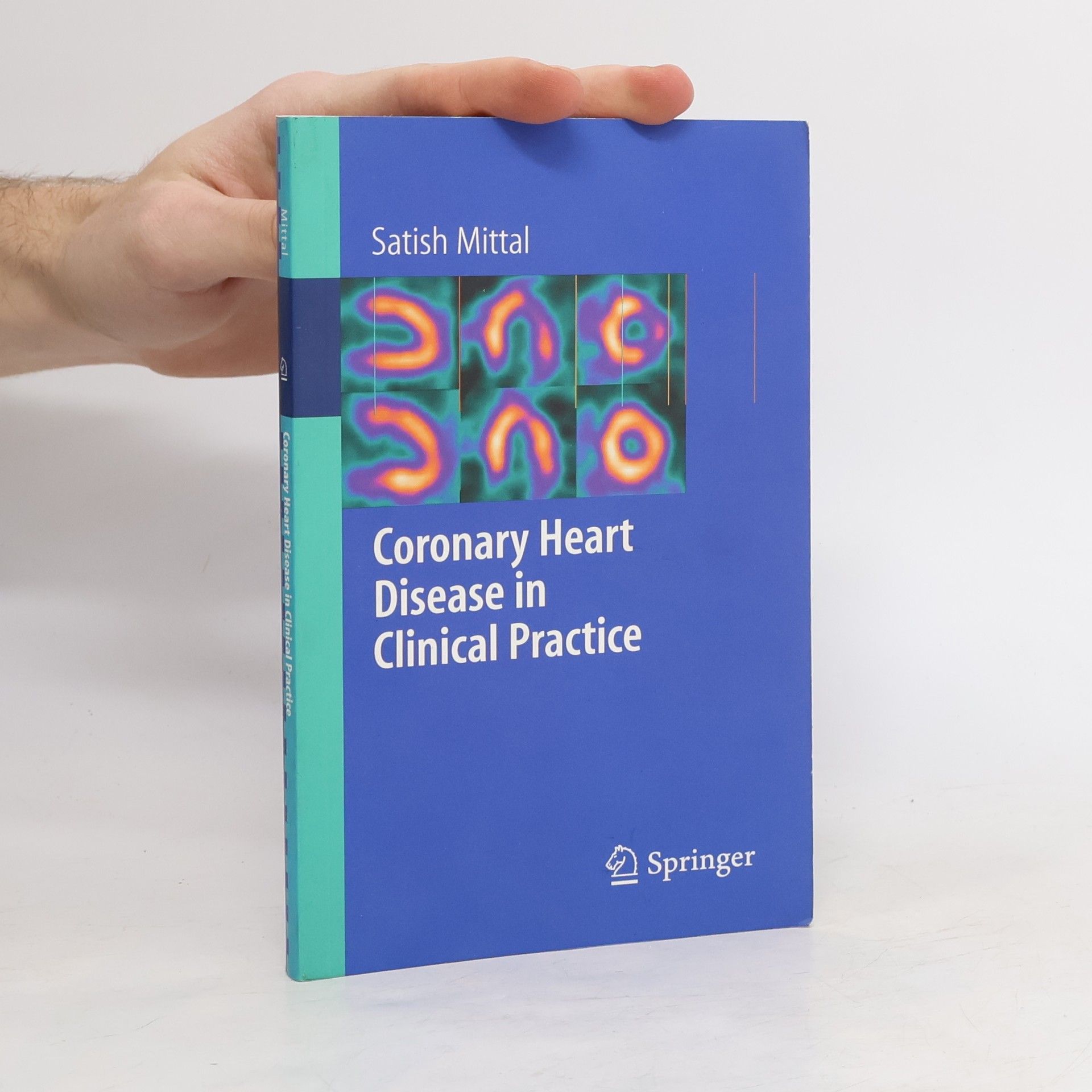 Satish Mittal Coronary Heart Disease in Clinical Practice