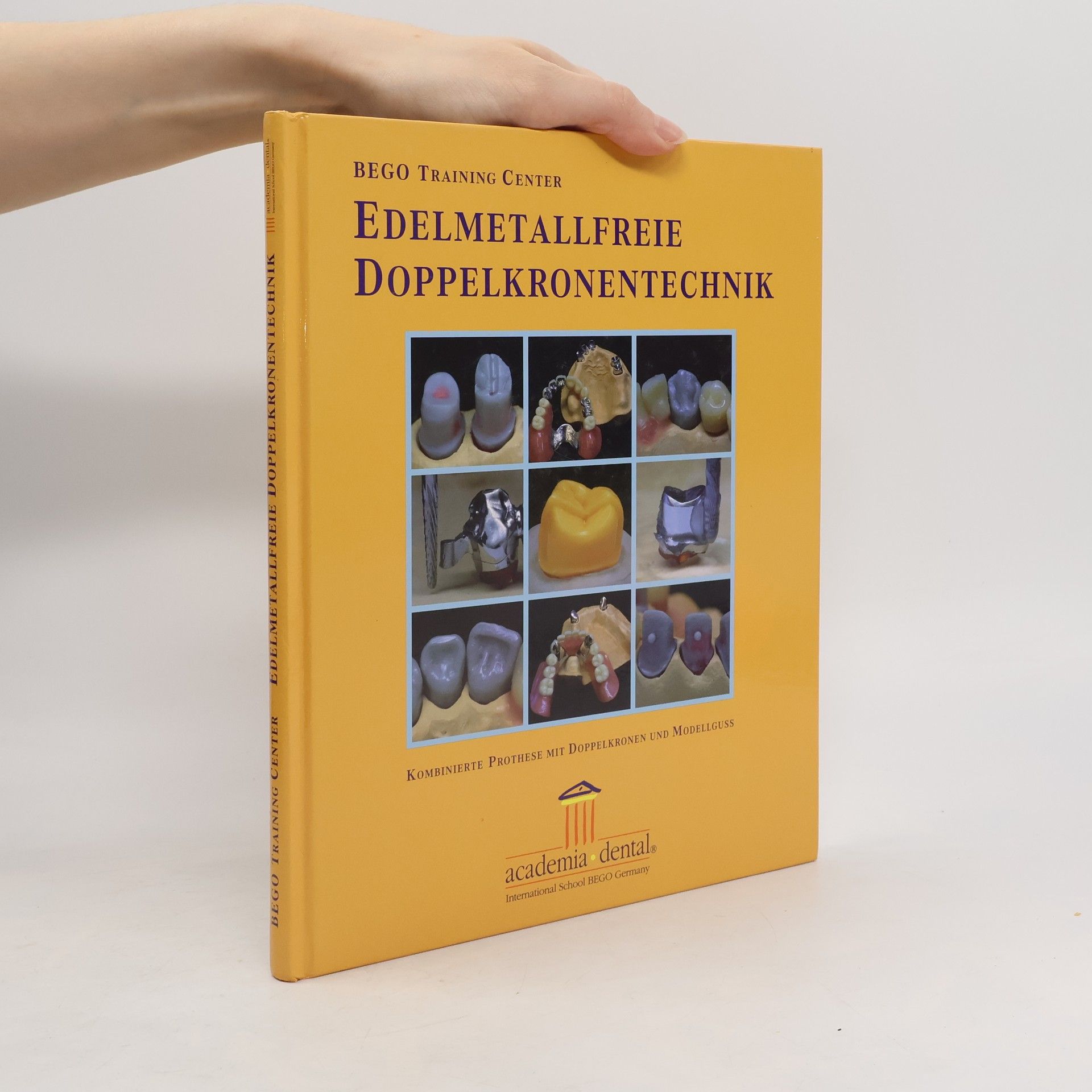 Henning Wulfes Edelmetallfreie Doppelkronentechnik