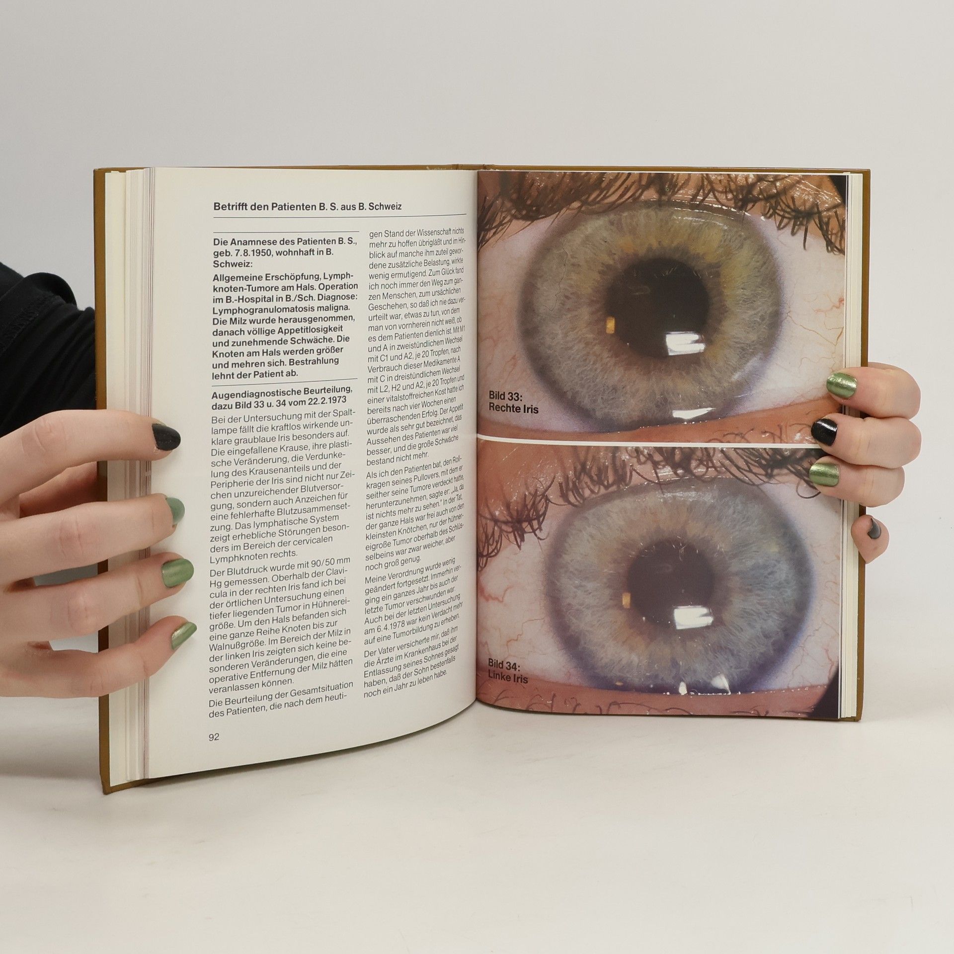 Josef Diener Körper und Seele – Wie viel verrät das Auge?