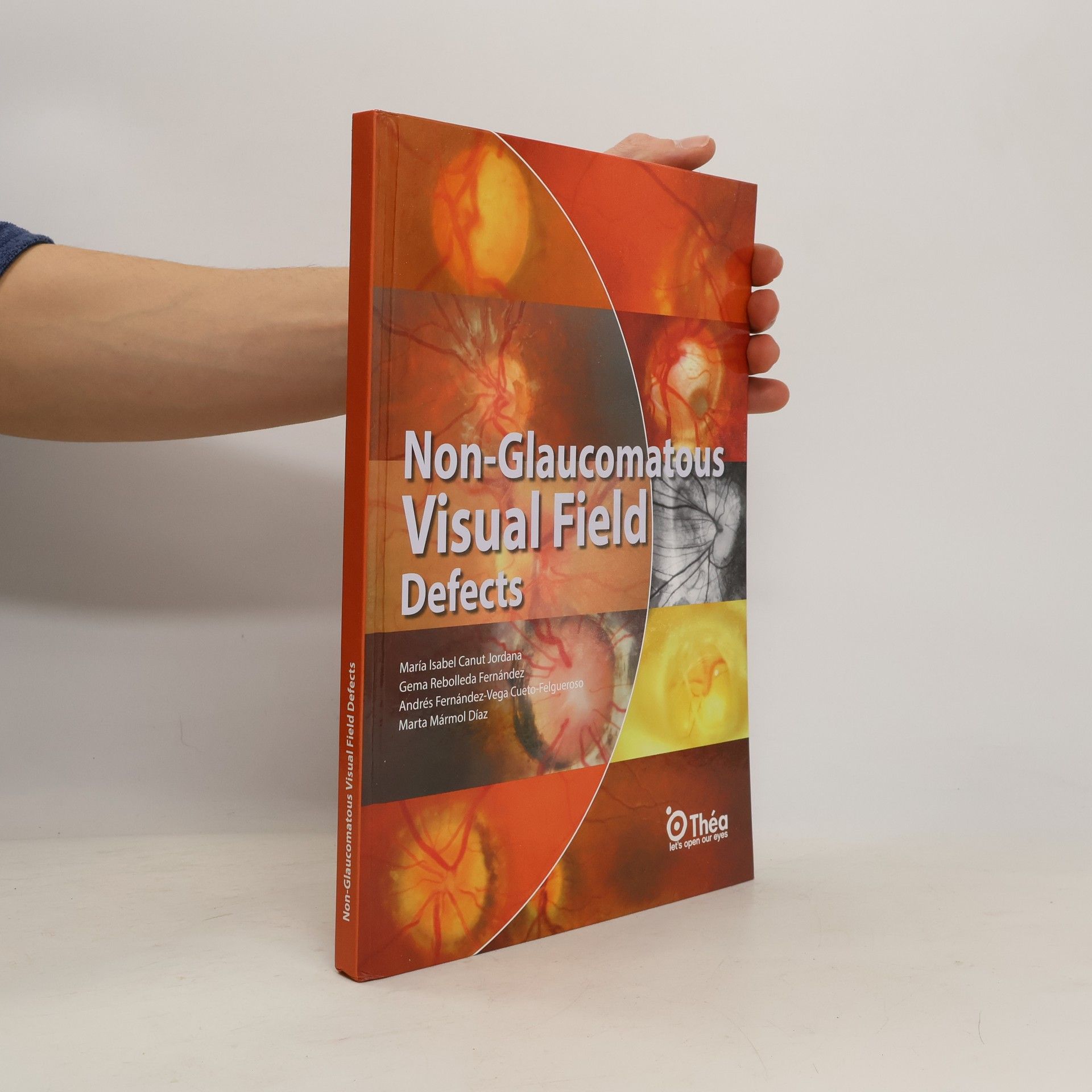 AA.VV. Non-Glaucomatous Visual Field Defects