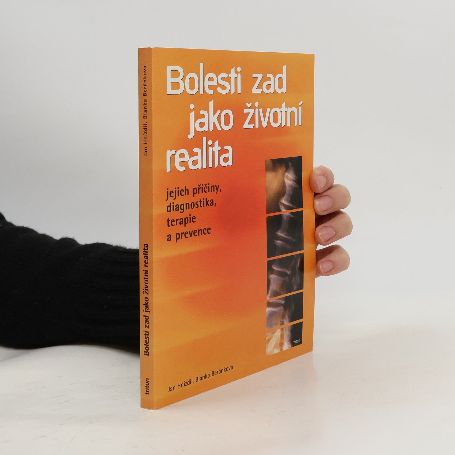Jan Hnízdil Bolesti zad jako životní realita. Jejich příčiny, diagnostika, terapie a prevence