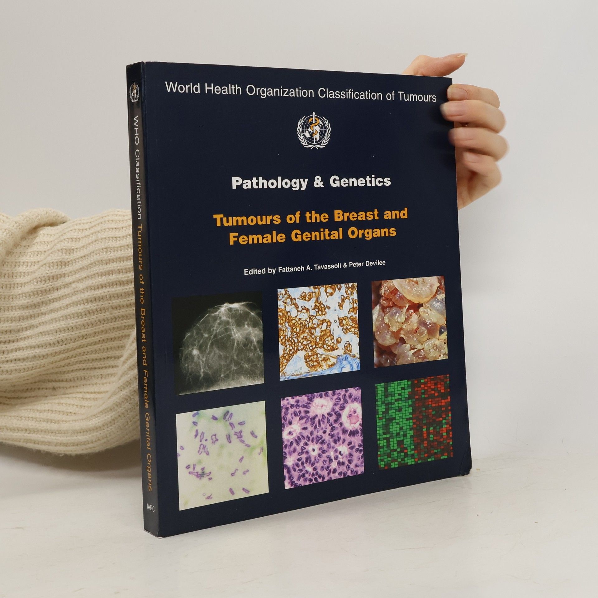 Collectif d'auteurs Pathology and Genetics of Tumours of the Breast and Female Genital Organs