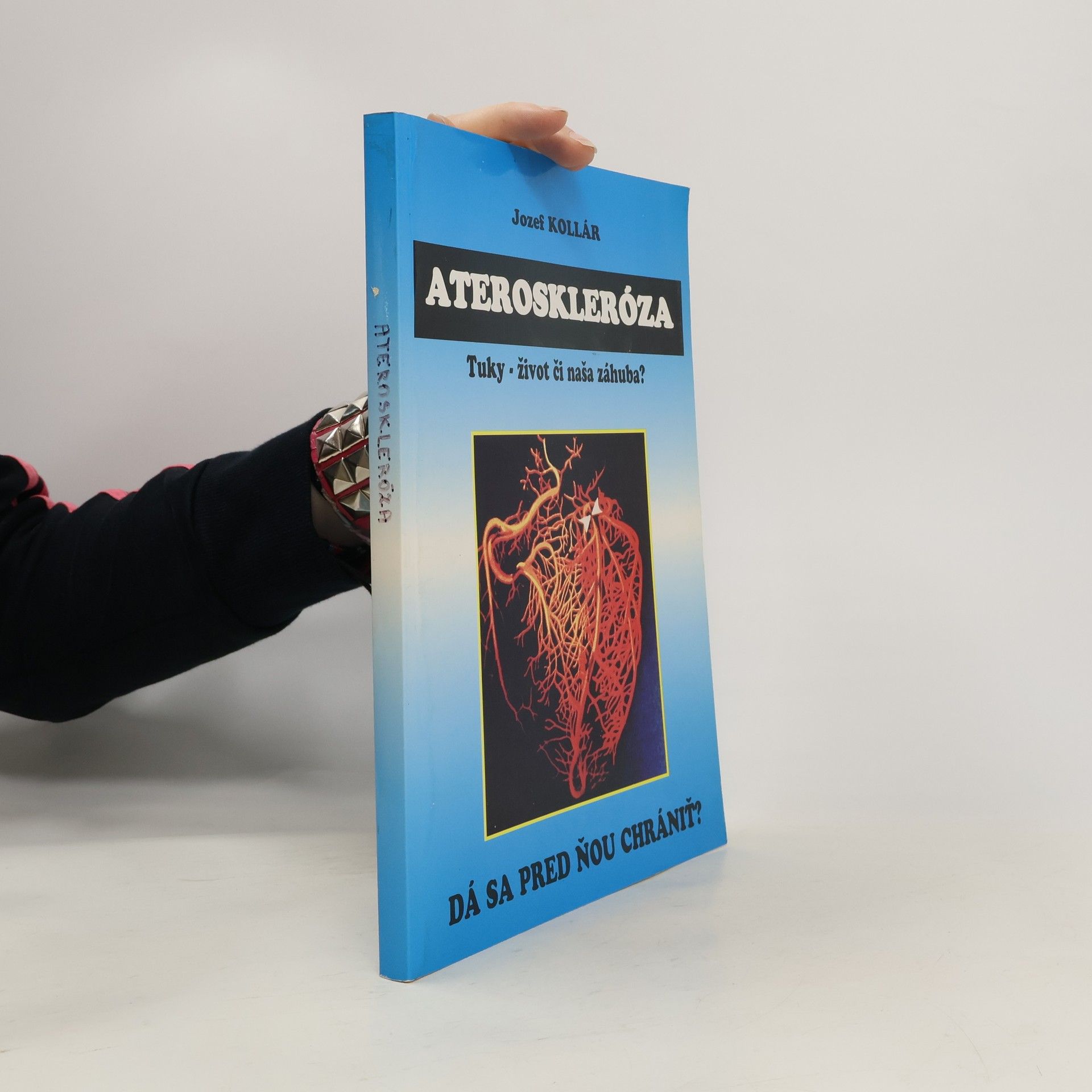 Jozef Kollár Ateroskleróza: Tuky - život či naša záhuba? - Dá sa pred ňou chrániť?