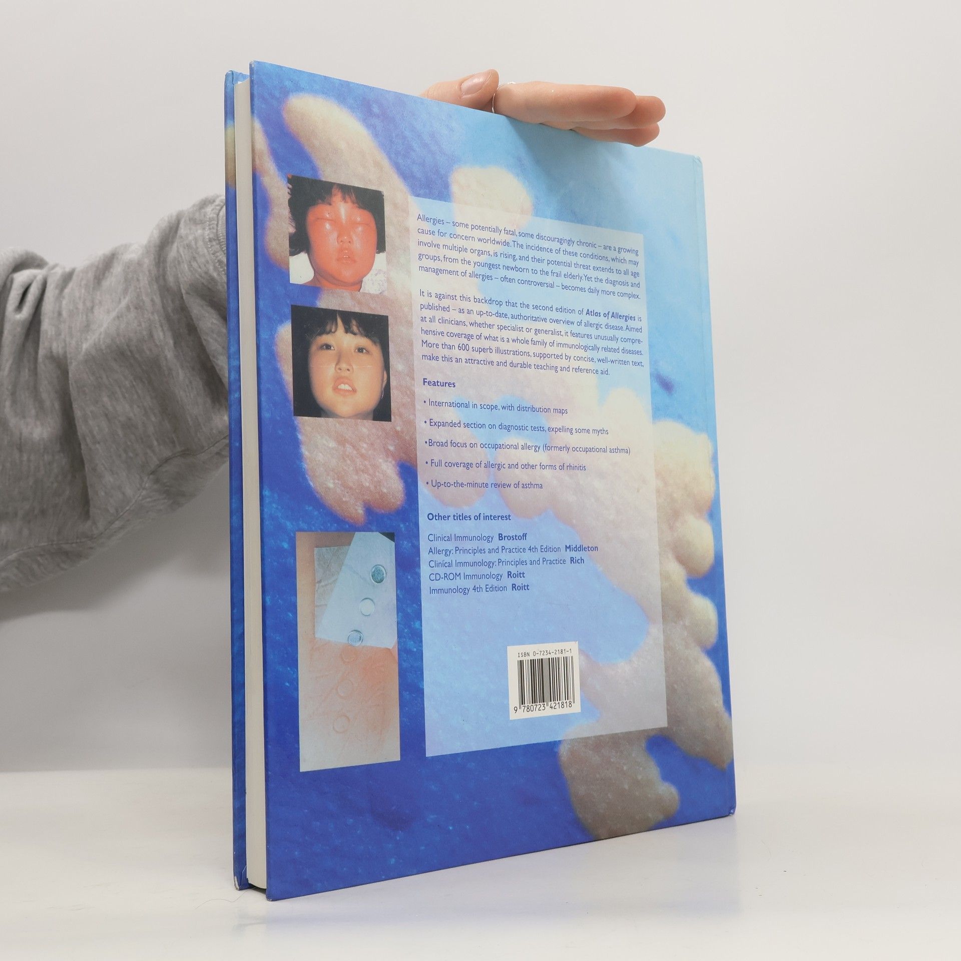 Philip Fireman Atlas of Allergies