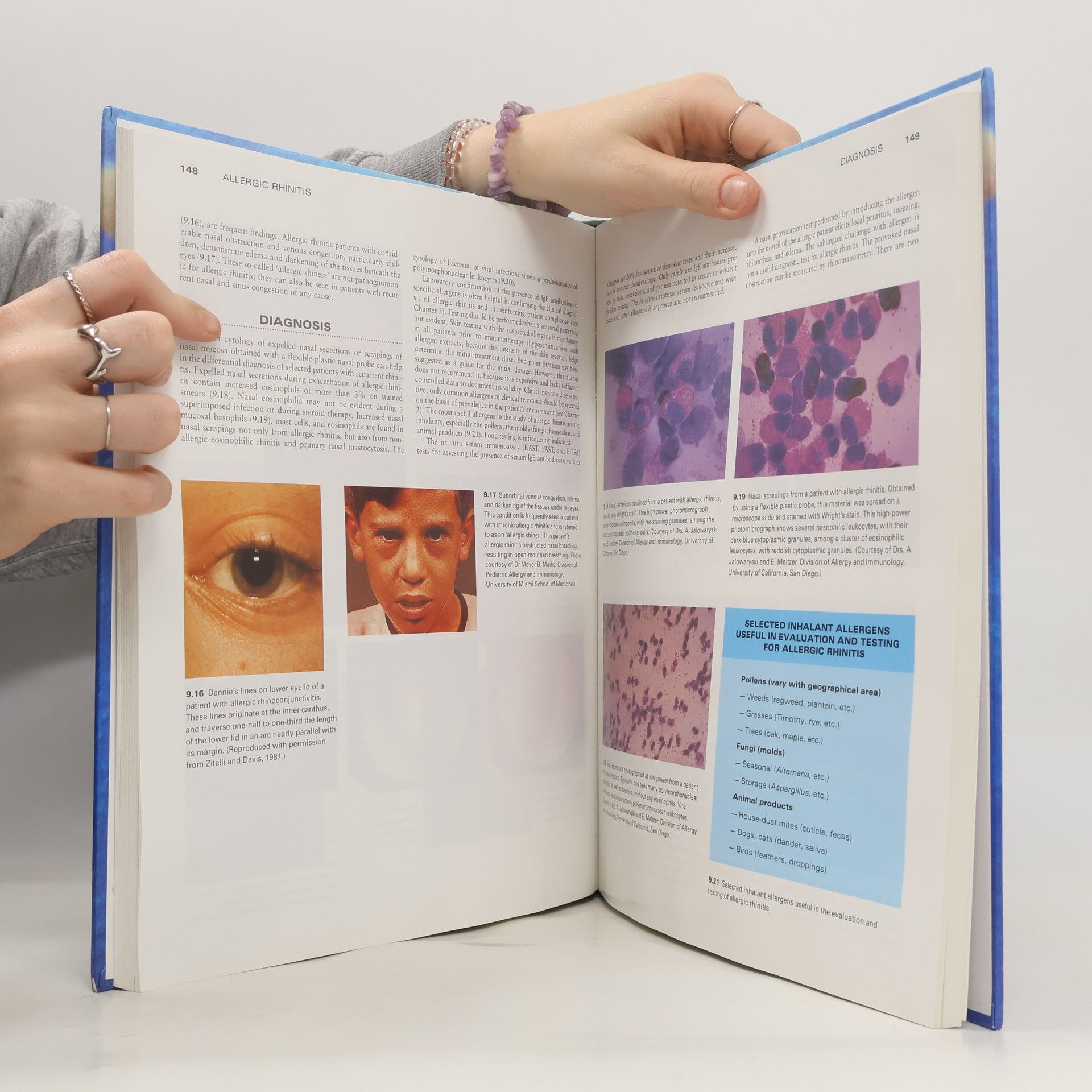 Philip Fireman Atlas of Allergies