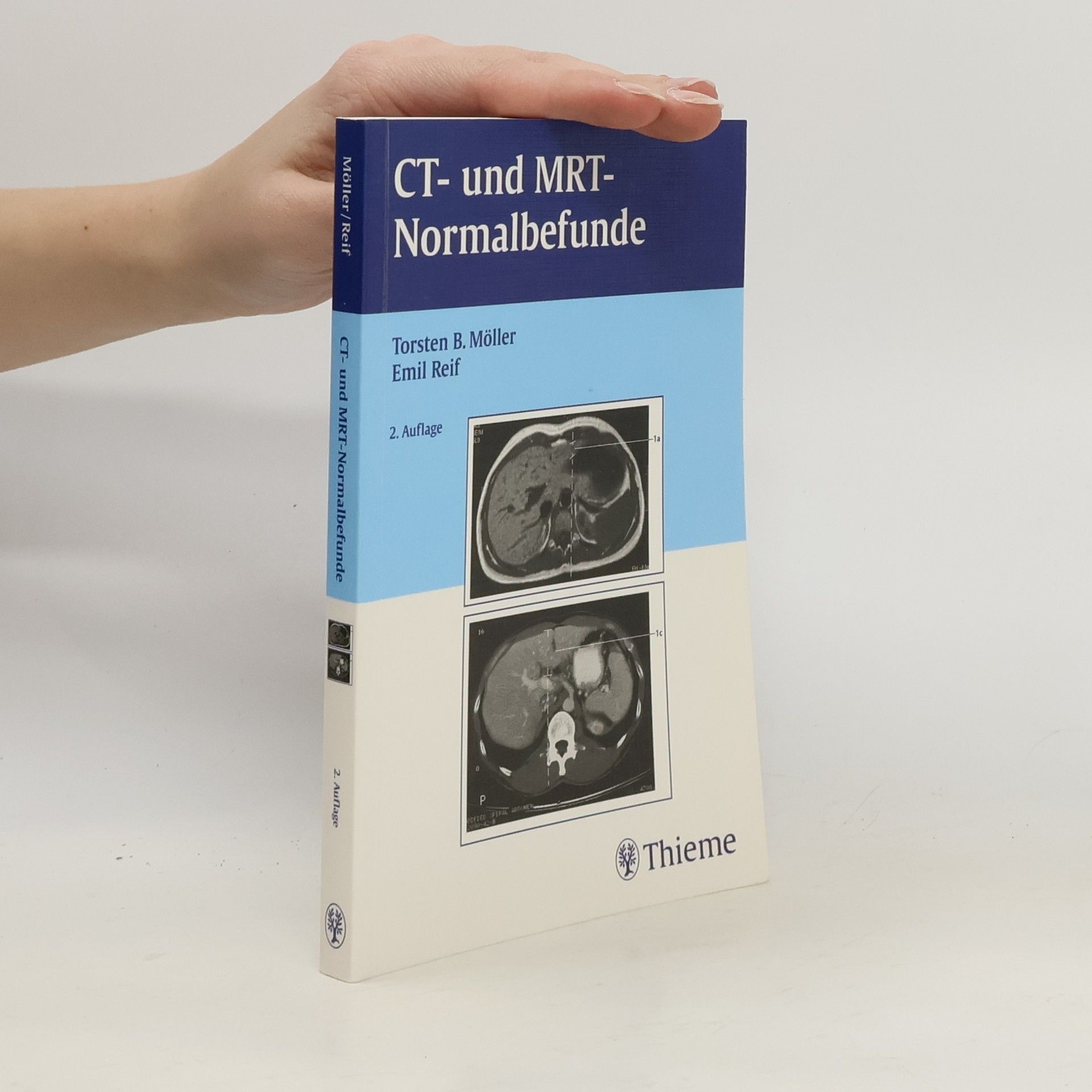 Torsten B. Möller CT- und MRT-Normalbefunde - 2. Auflage