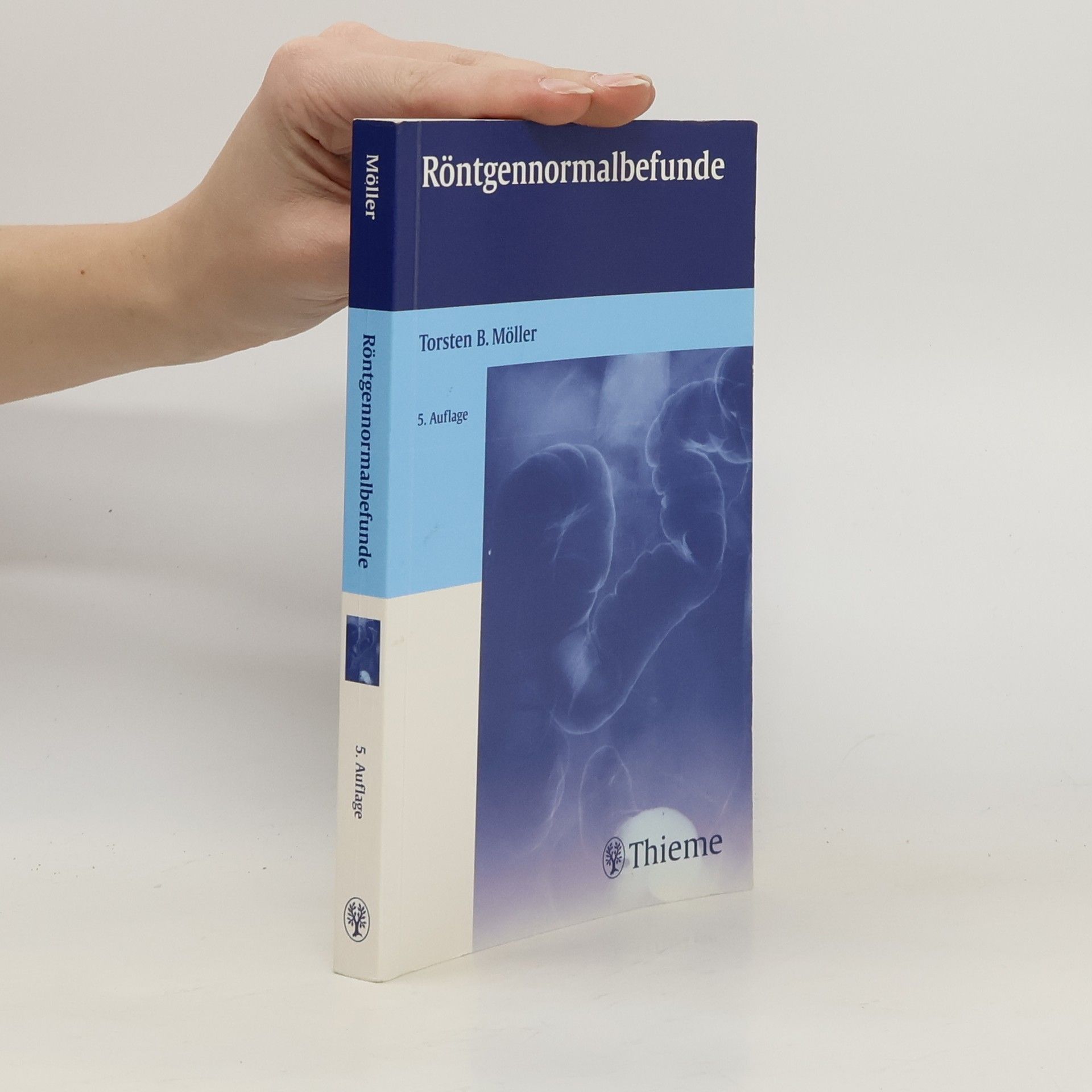 Torsten B. Möller Röntgennormalbefunde - 5. Auflage