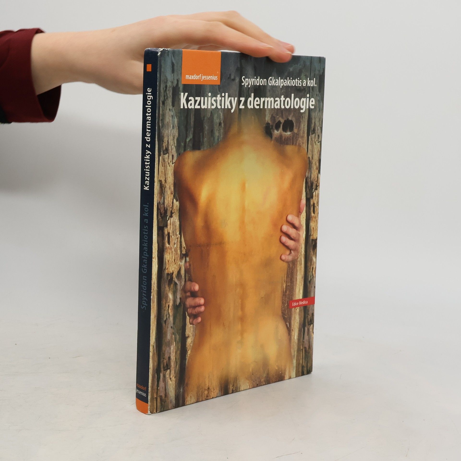 Spyridon Gkalpakiotis Kazuistiky z dermatologie