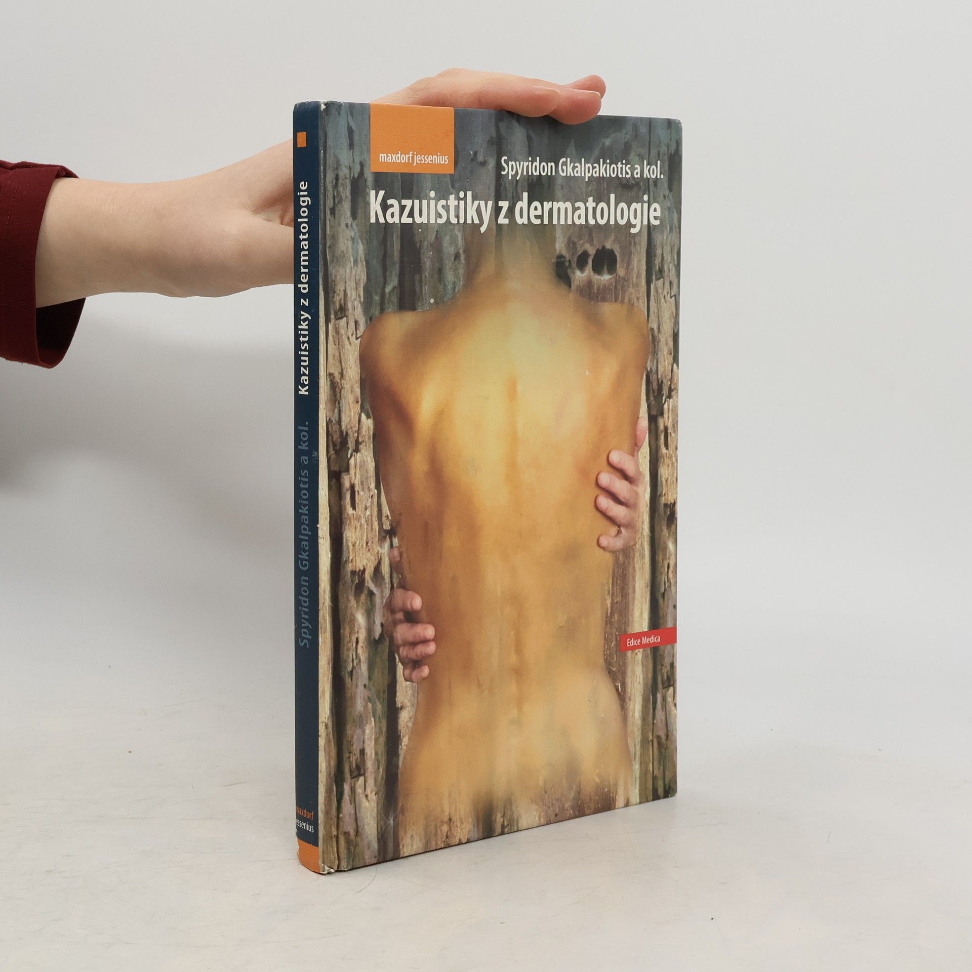 Spyridon Gkalpakiotis Kazuistiky z dermatologie