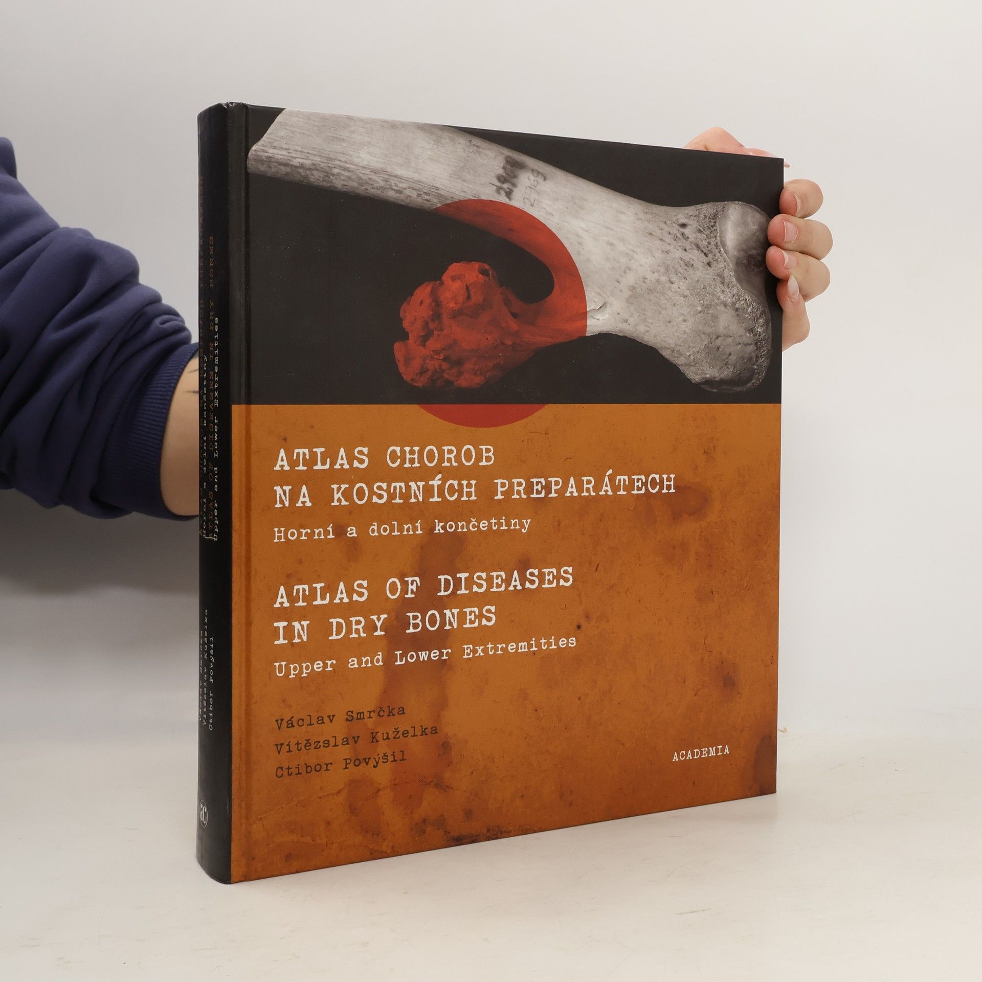 Václav Smrčka Atlas chorob na kostních preparátech
