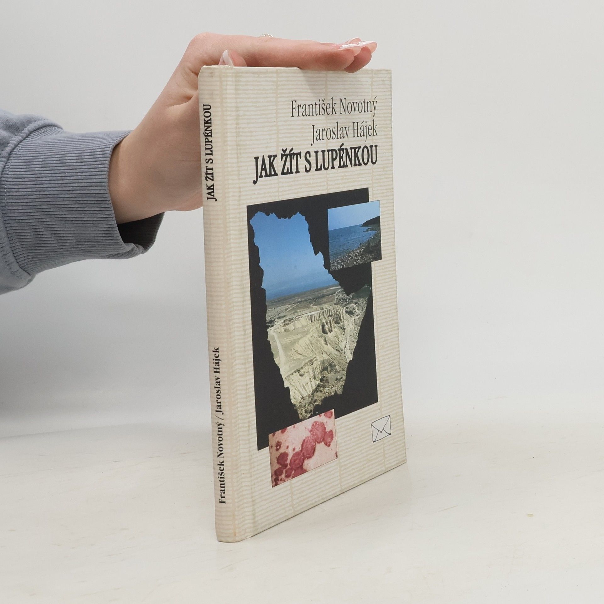 František Novotný Jak žít s lupénkou