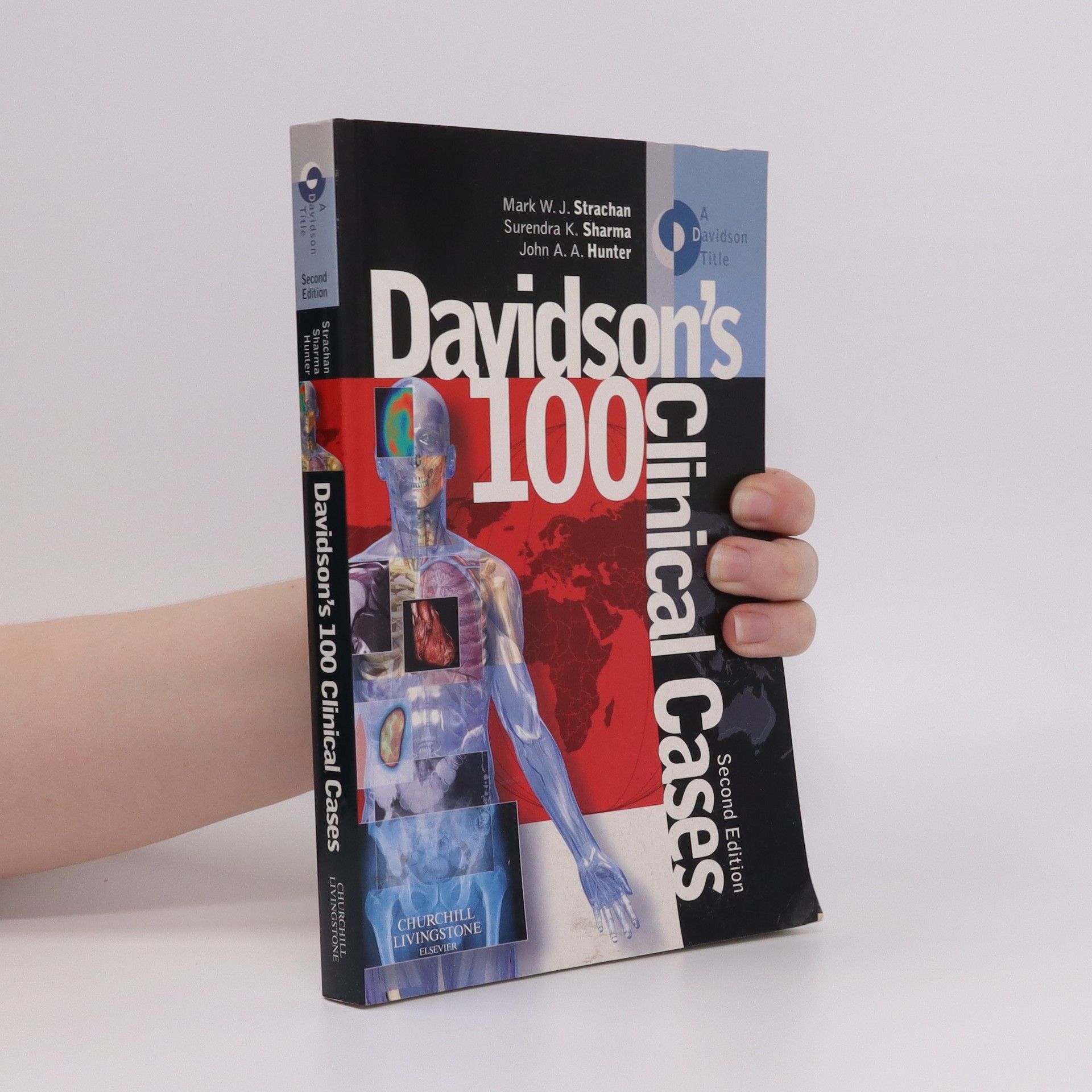 Stanley Davidson Davidson's 100 clinical cases