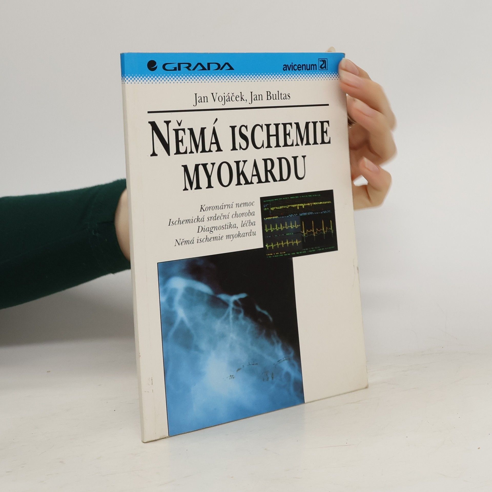 Jan Vojáček Němá ischemie myokardu