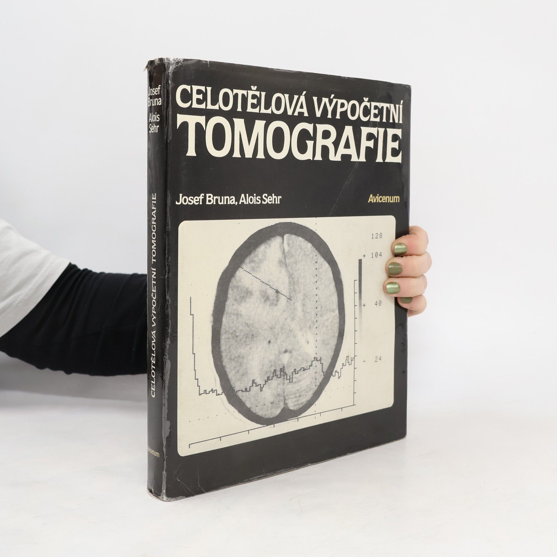 Josef Bruna Celotělová výpočetní tomografie