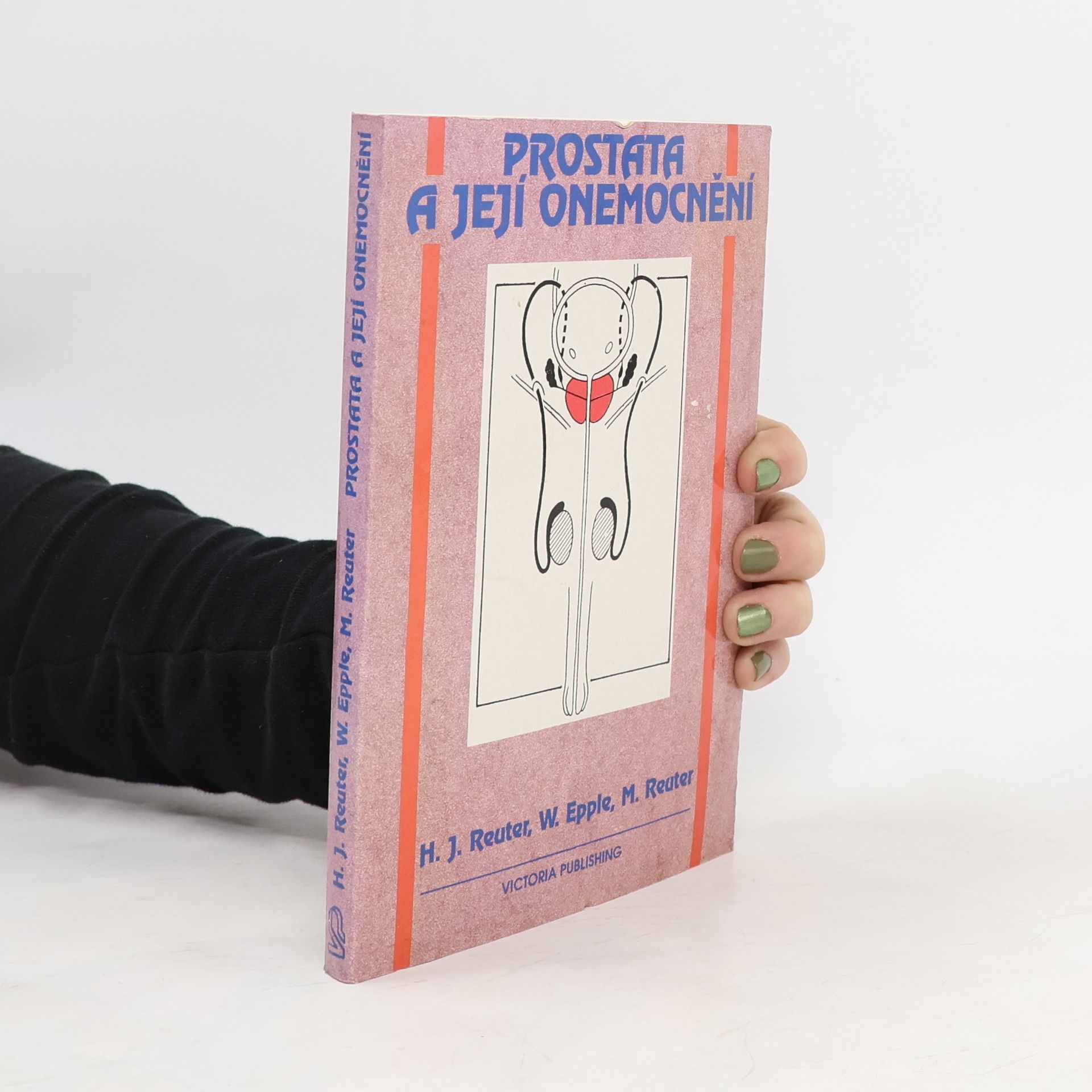 Prostata a její onemocnění