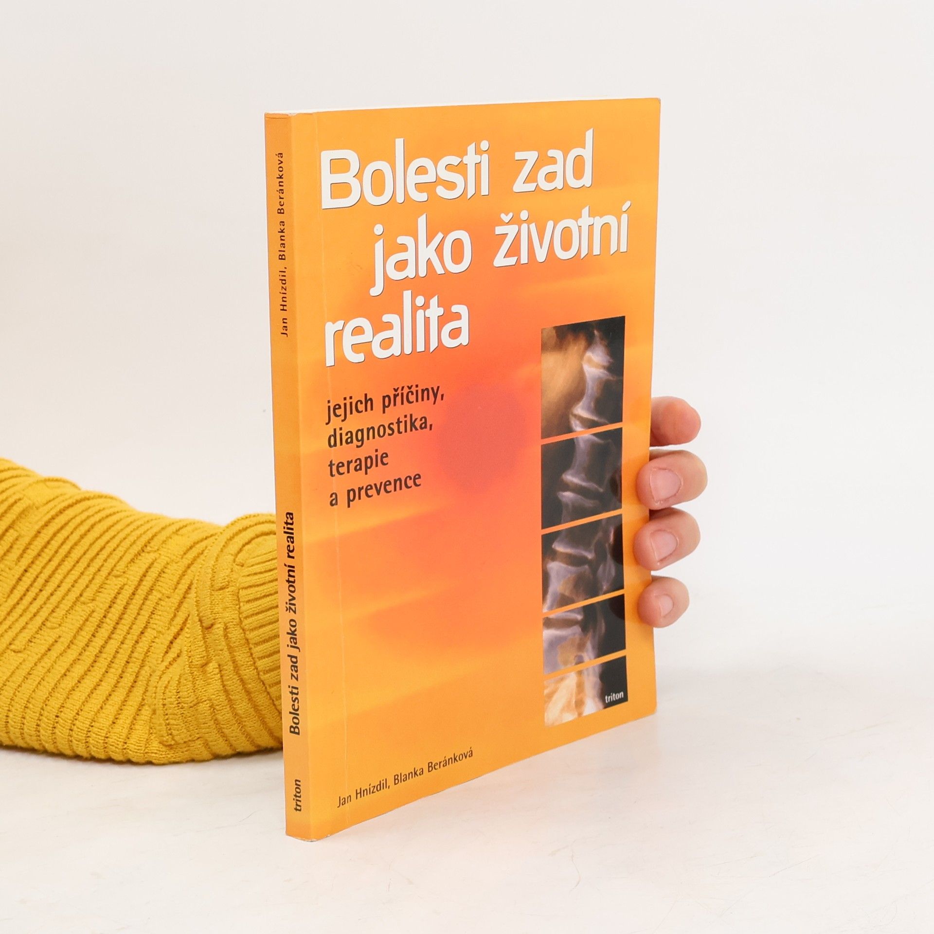 Jan Hnízdil Bolesti zad jako životní realita. Jejich příčiny, diagnostika, terapie a prevence