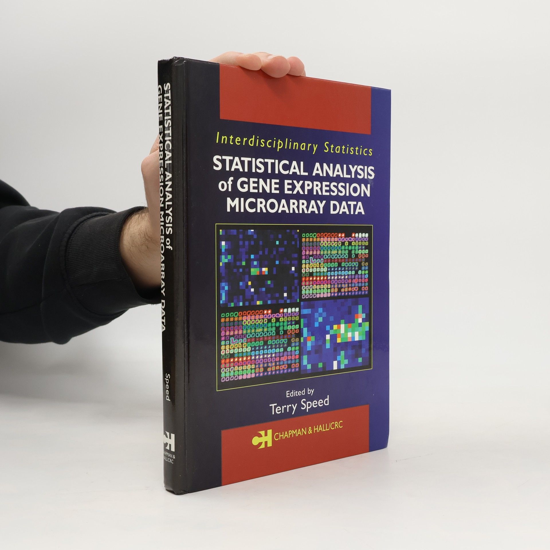 Terry Speed Statistical Analysis of Gene Expression Microarray Data