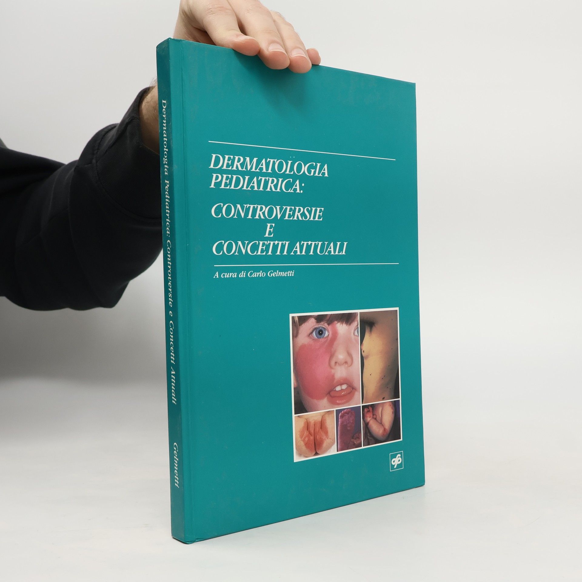 Dermatologia pediatrica: controversie e concetti attuali