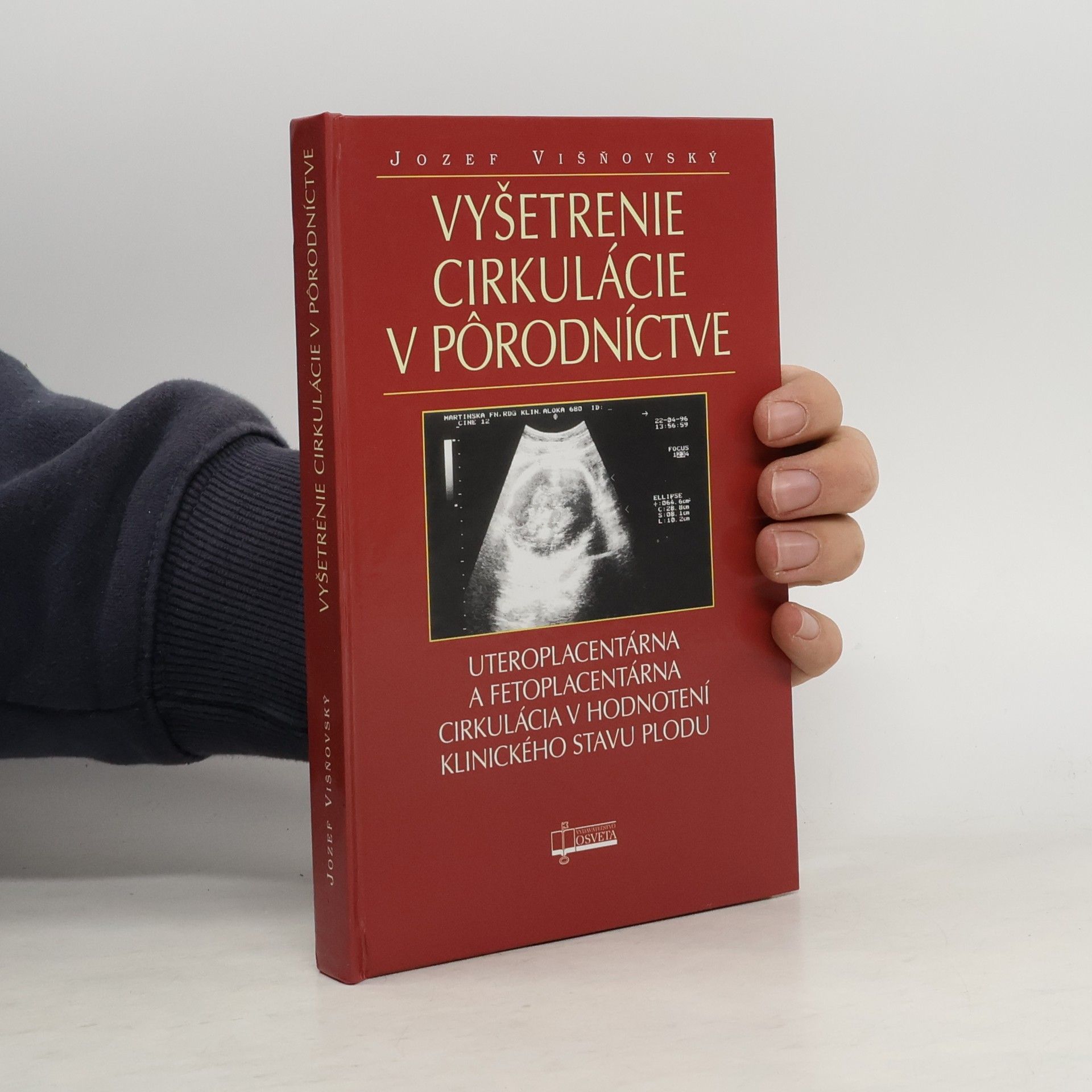 Jozef Višňovský Vyšetrenie cirkulácie v pôrodníctve