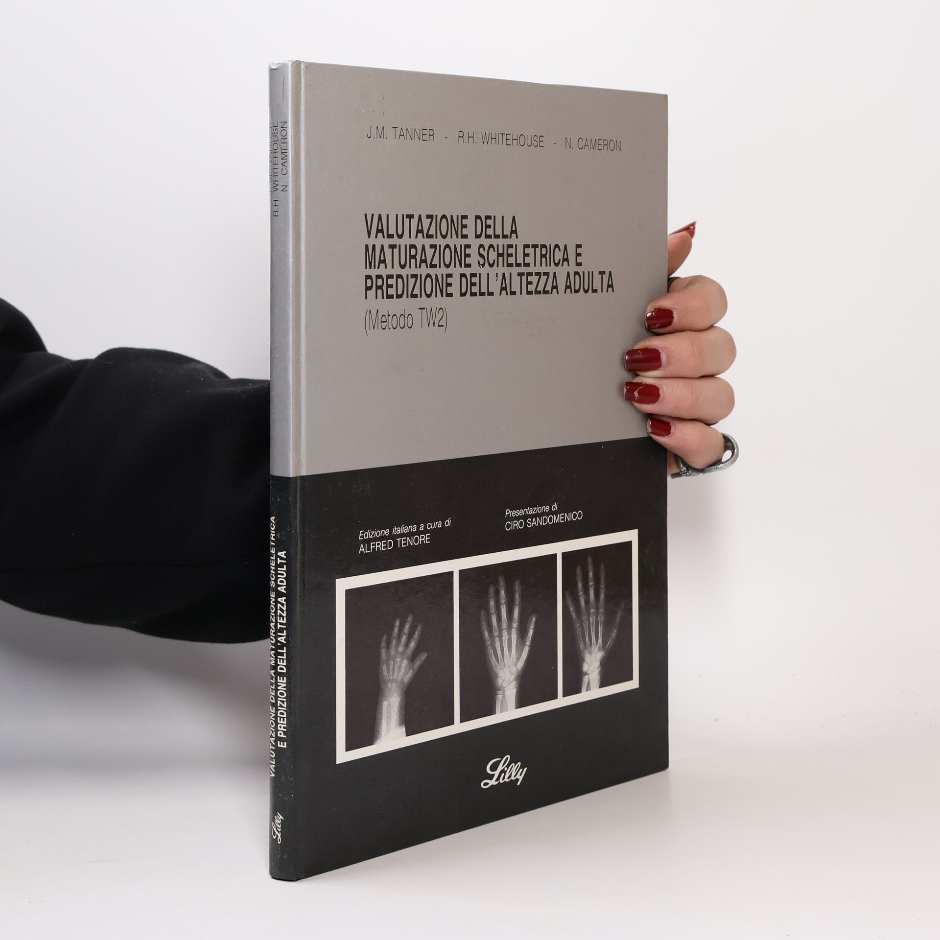 James Mourilyan Tanner Valutazione della maturazione scheletrica e predizione dell'altezza adulta