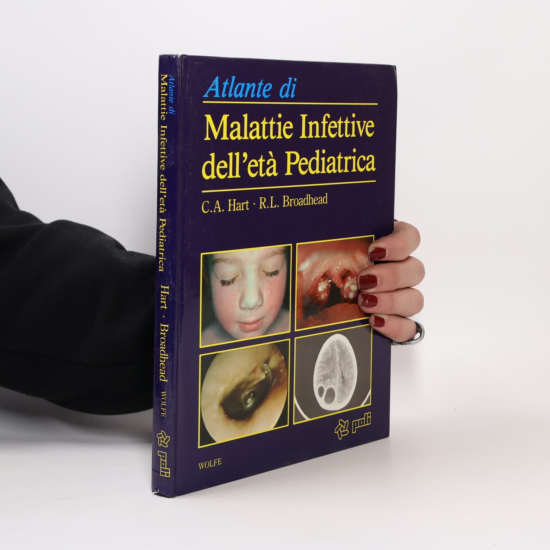 R. L. Broadhead Atlante di Malattie Infettive dell'età Pediatrica