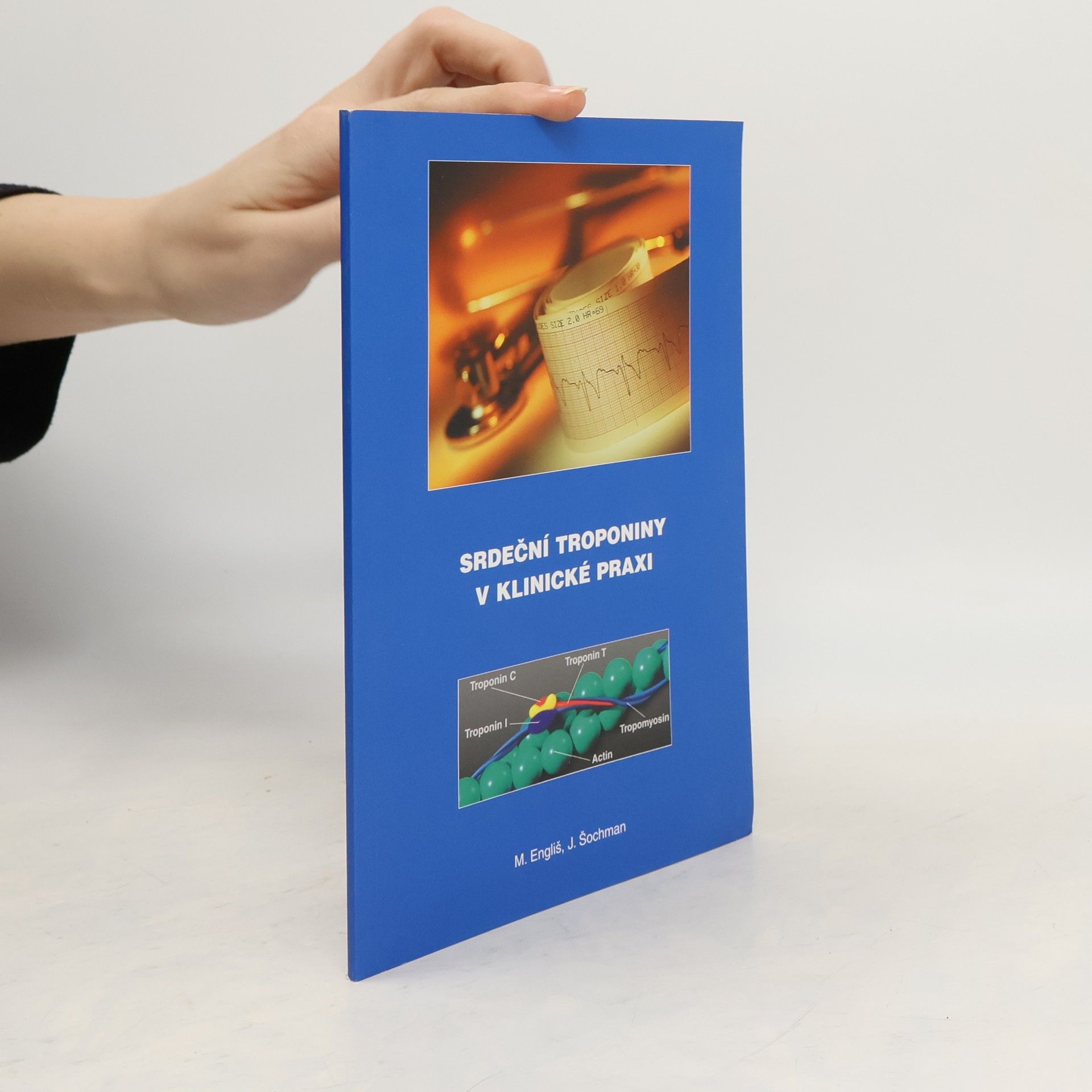 Srdeční troponiny v klinické praxi