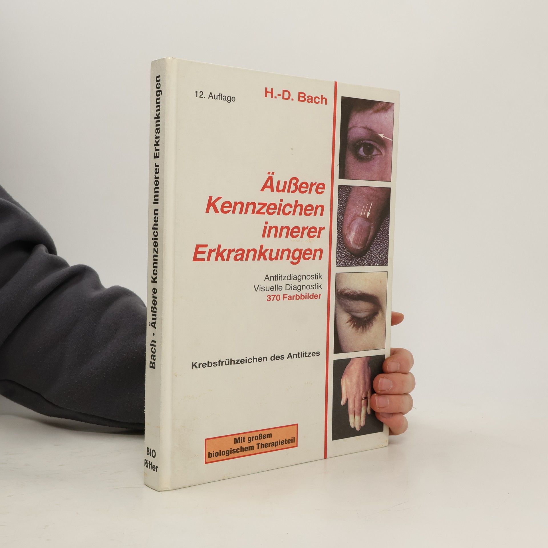 Auteurscollectief Äussere Kennzeichen innerer Erkrankungen