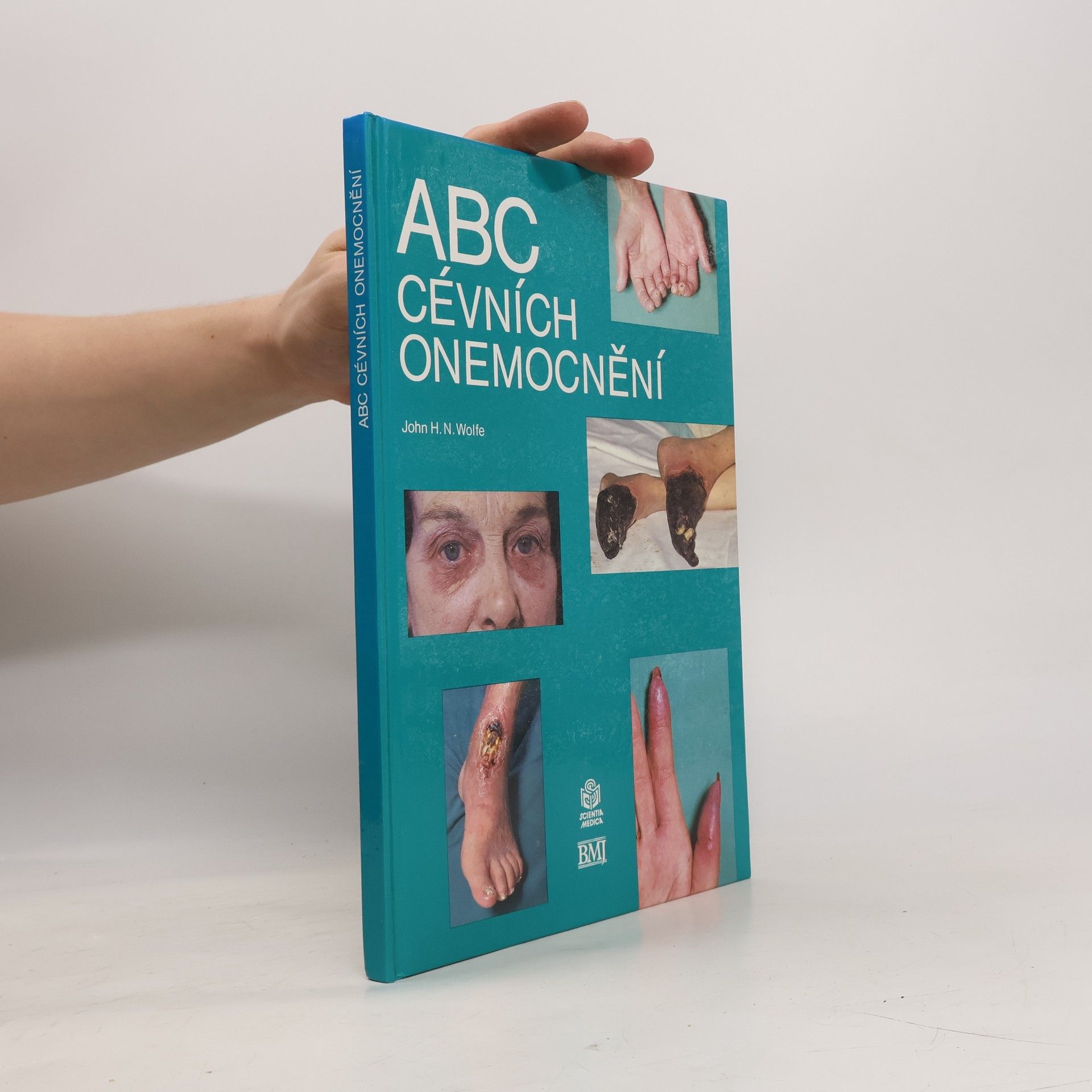 ABC cévních onemocnění